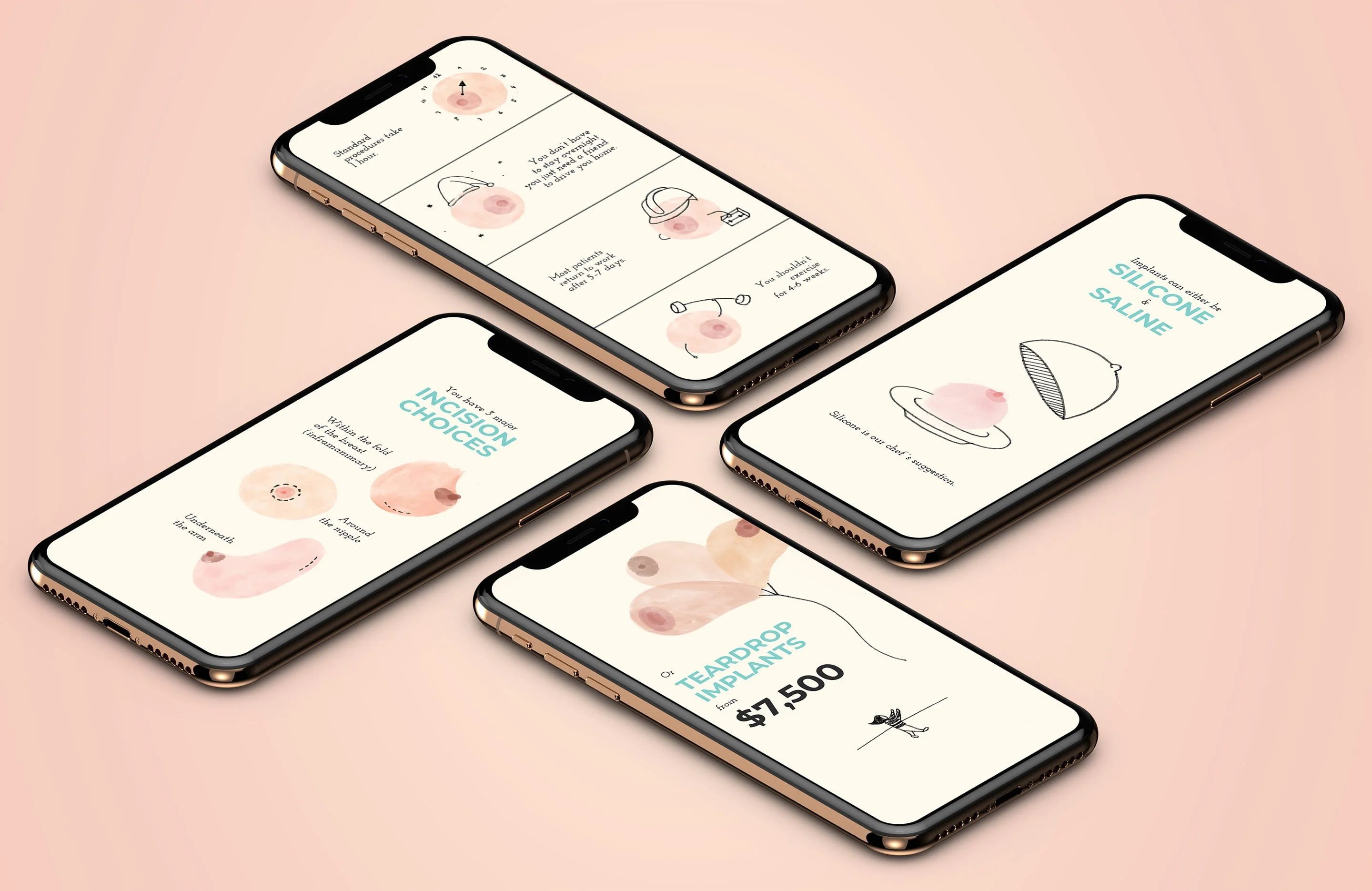 Four phones on peach showing illustrated Faceboobs screens: incision choices, silicone and saline, teardrop implants $7,500
