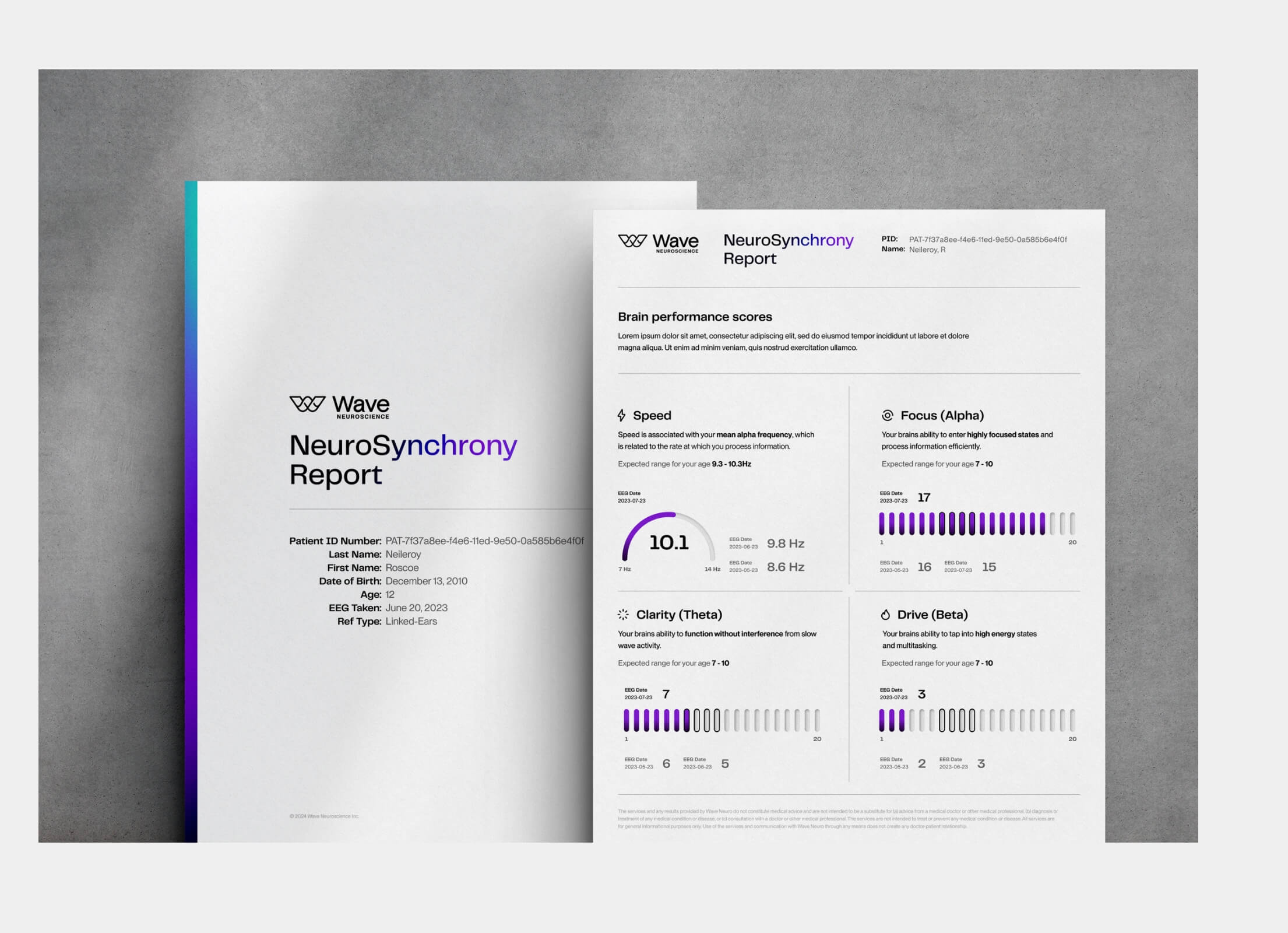 Here comes the alt text