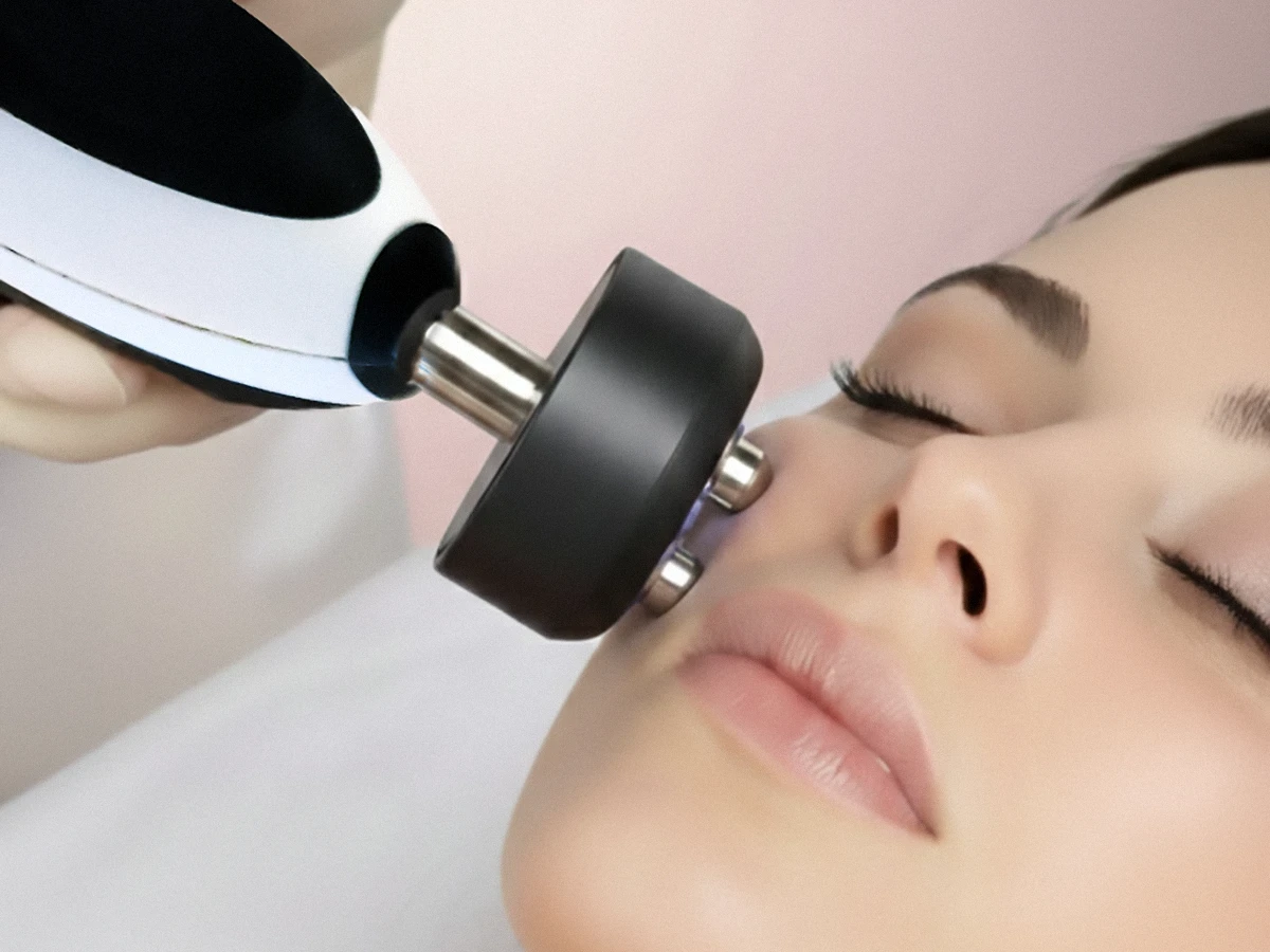 Radiofrekvences liftinga procedūra ādas nostiprināšanai