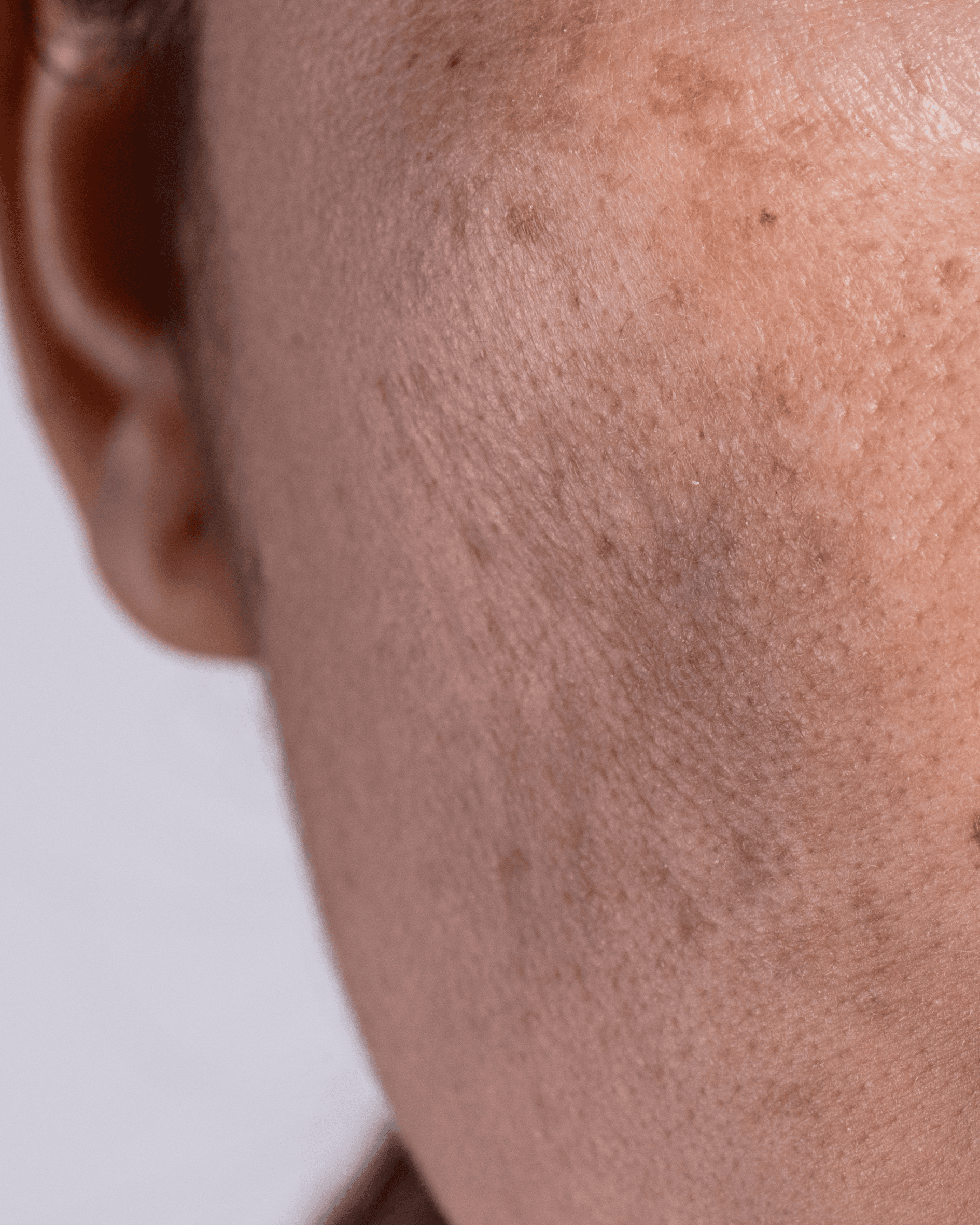 A close up of a woman with freckles on her arm