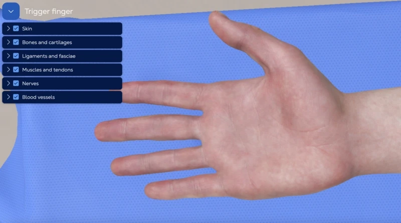 Trigger finger release