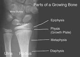 The Growth Plate - Connecticut Orthopaedics