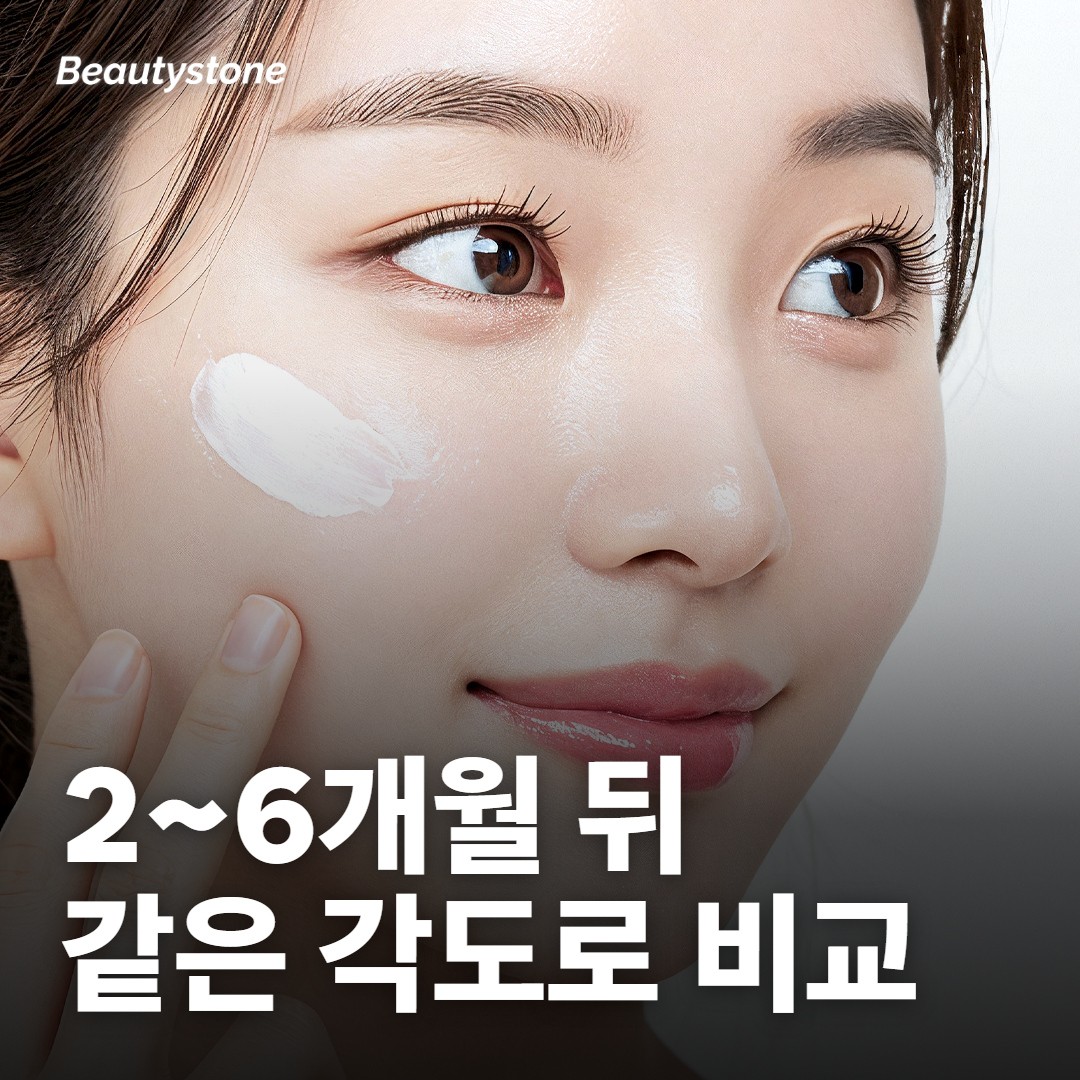 효과는 몇 달에 걸쳐 올라와요