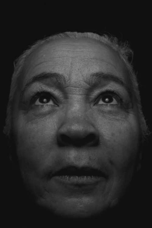 Face Lift in Miami, FL