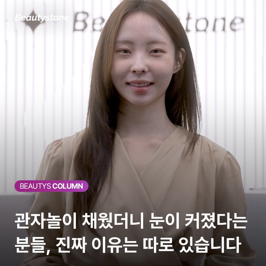 눈 안 건드리고 눈 커지는 법? 관자필러가 만드는 텐트효과의 해부학적 비밀