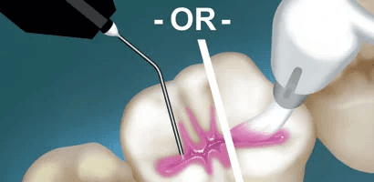 Restorvative & Preventative