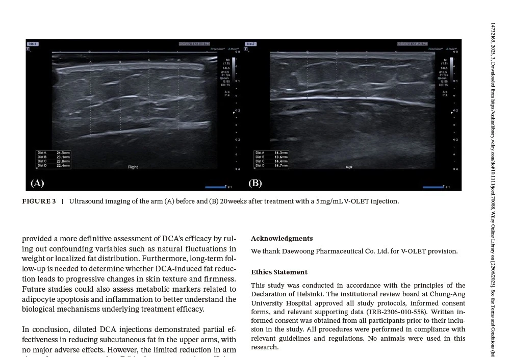 fat thickness ultrasound