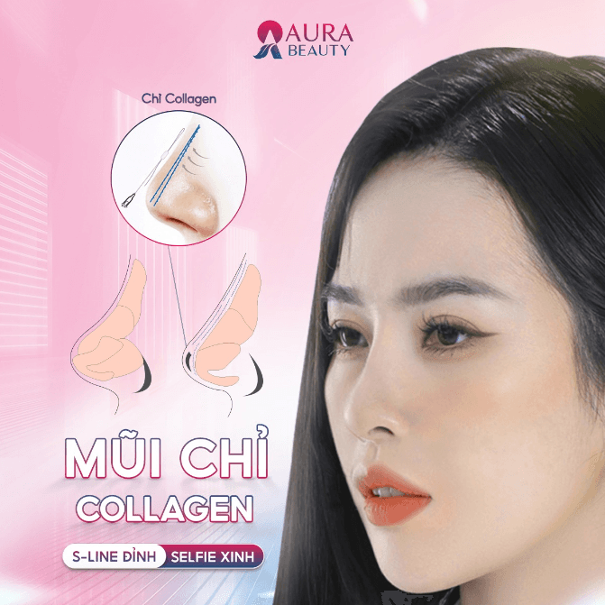 Các ưu điểm khi nâng mũi bằng chỉ collagen tại Thẩm mỹ viện Aura Cần Thơ