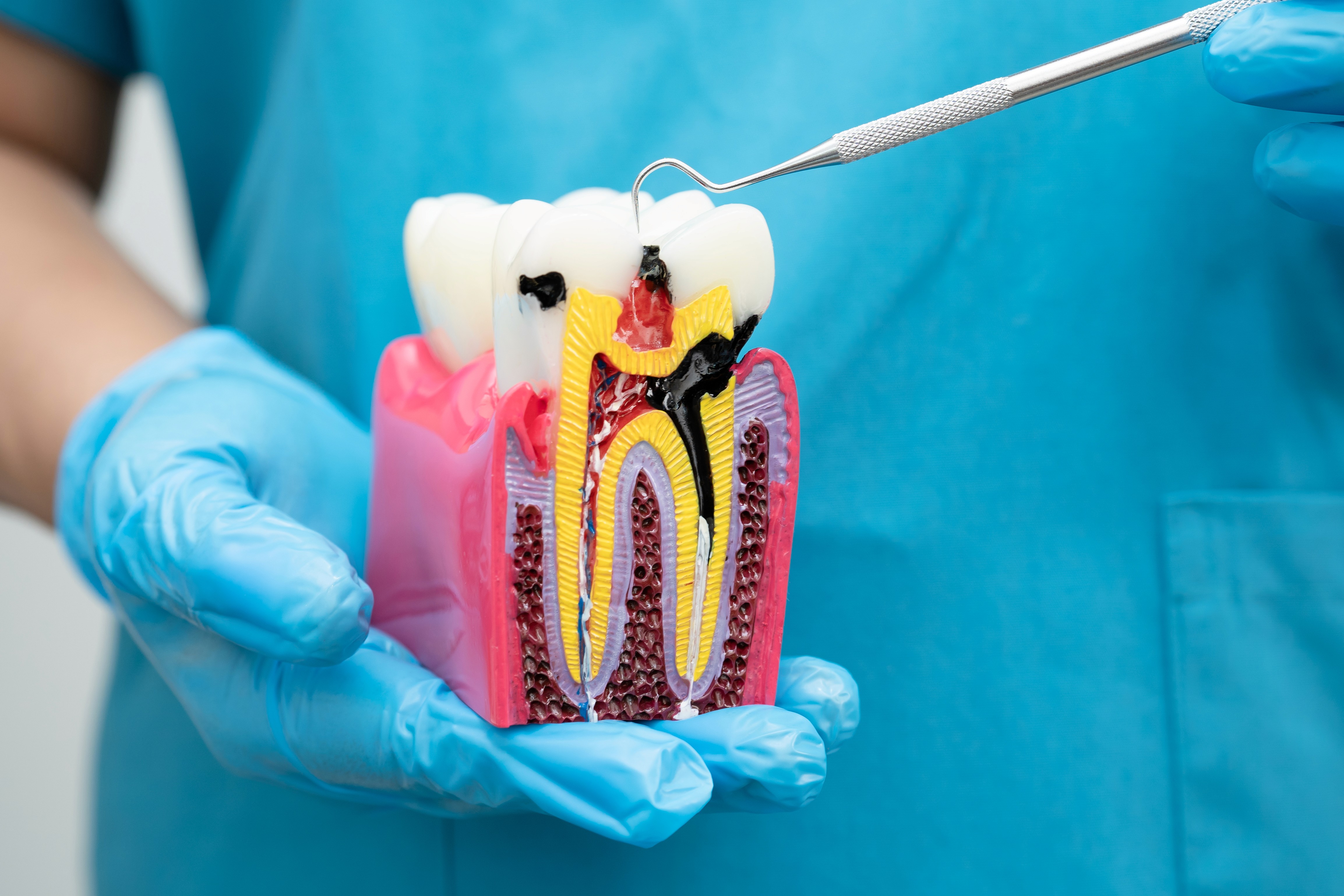 closeup of a dentist measuring a womans teeth color