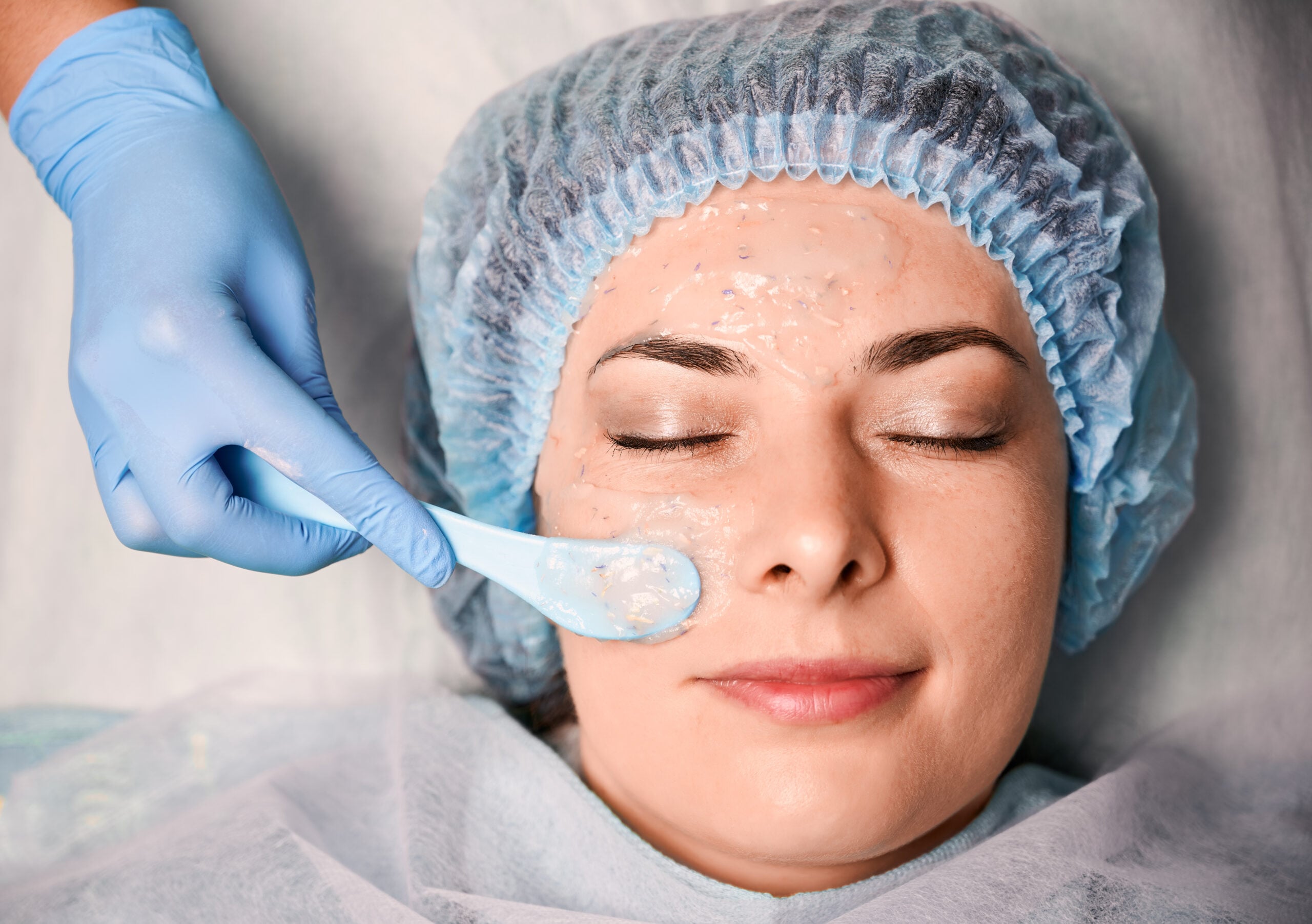 Aesthetician applying Cosmelan depigmentation peel with blue spatula.