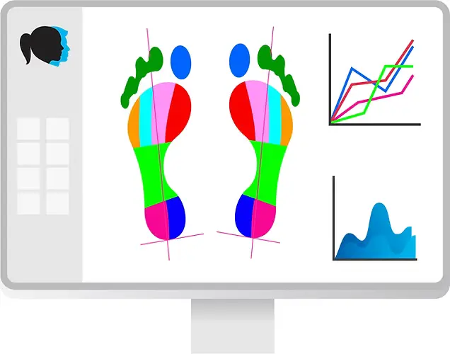 Computer screen showing Footscan gait and pressure analysis results, helping design custom 3D-printed insoles and orthotics for foot pain, plantar fasciitis, flat feet, high arches, and Morton's neuroma at Limitless Orthotics clinic, Leeds.
