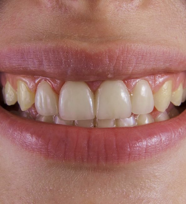 Why emergency dental care matters