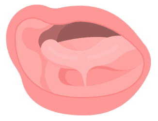 Tongue tie frenectomy oral procedure icon