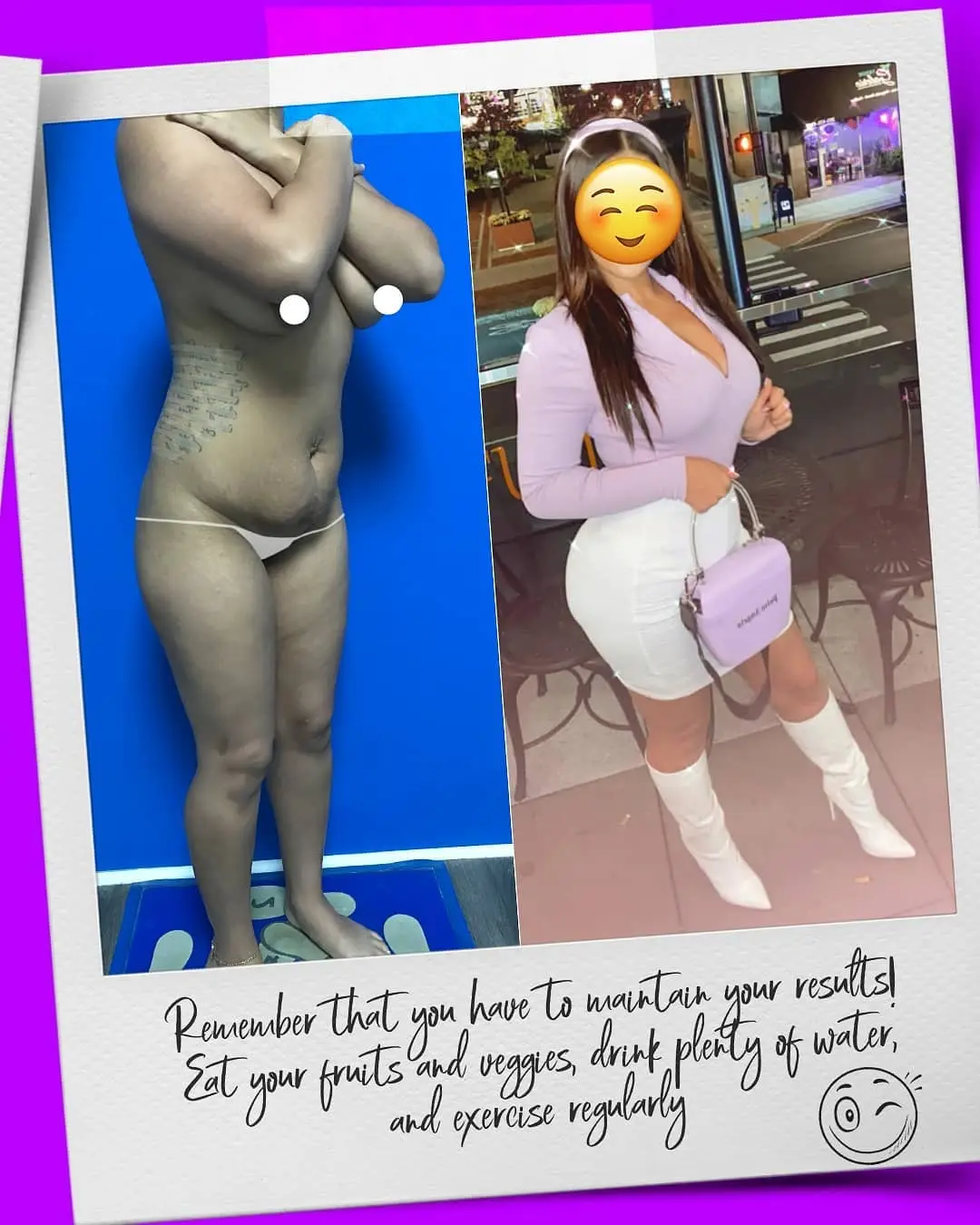 A grey car parked in a grass field in a hilly area