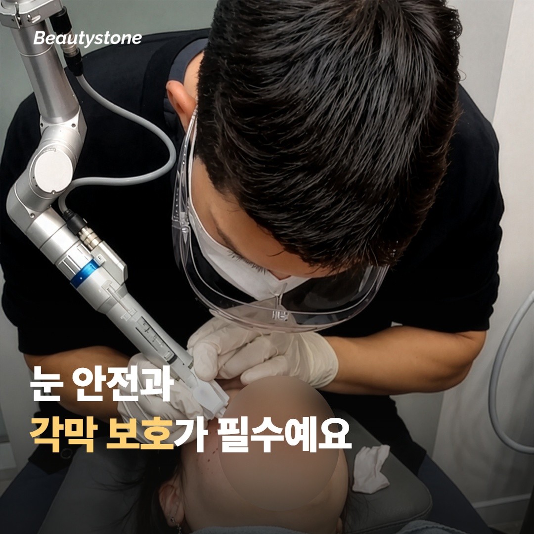 눈 안전·각막 보호가 필수예요