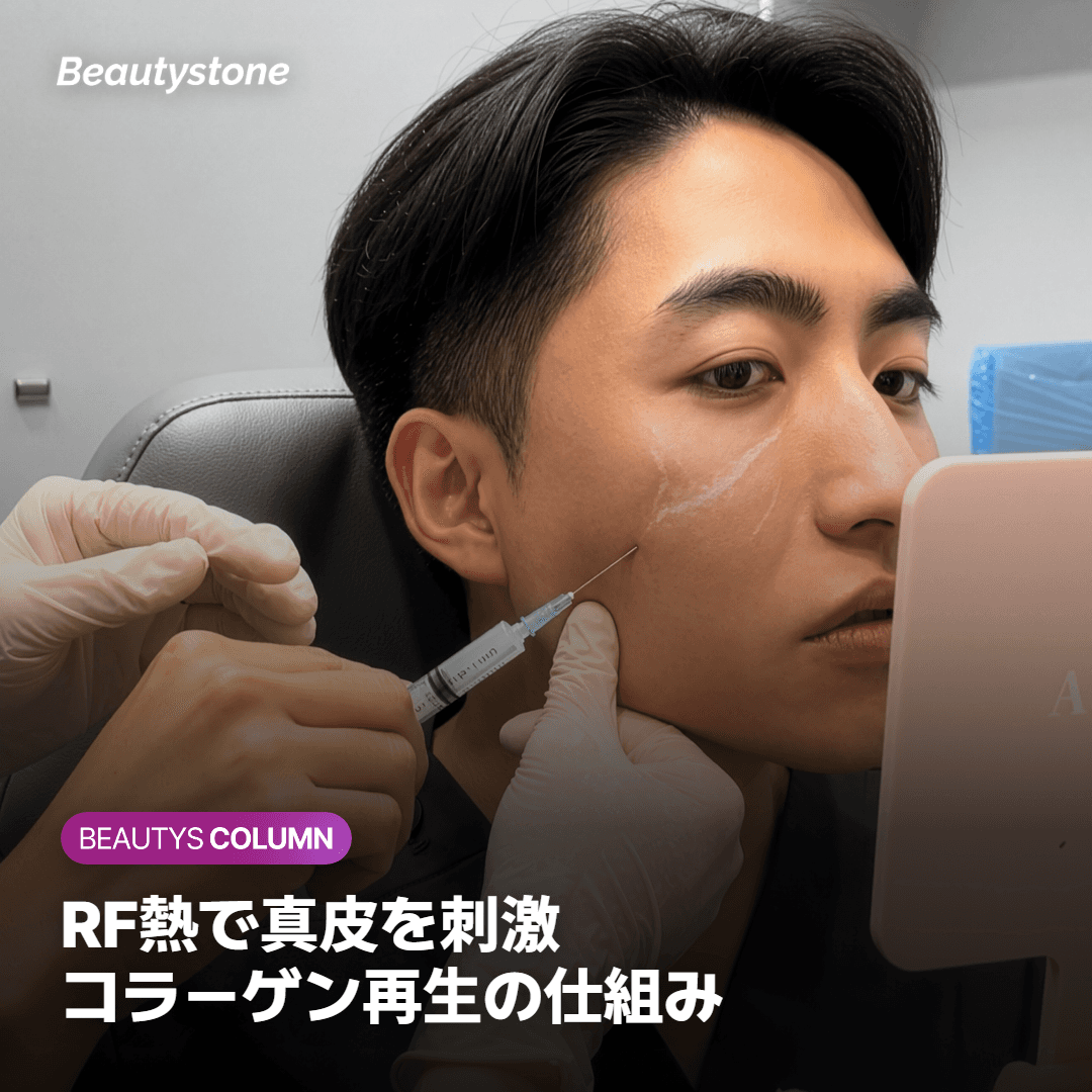 チタンリフティングとは？仕組みと特徴