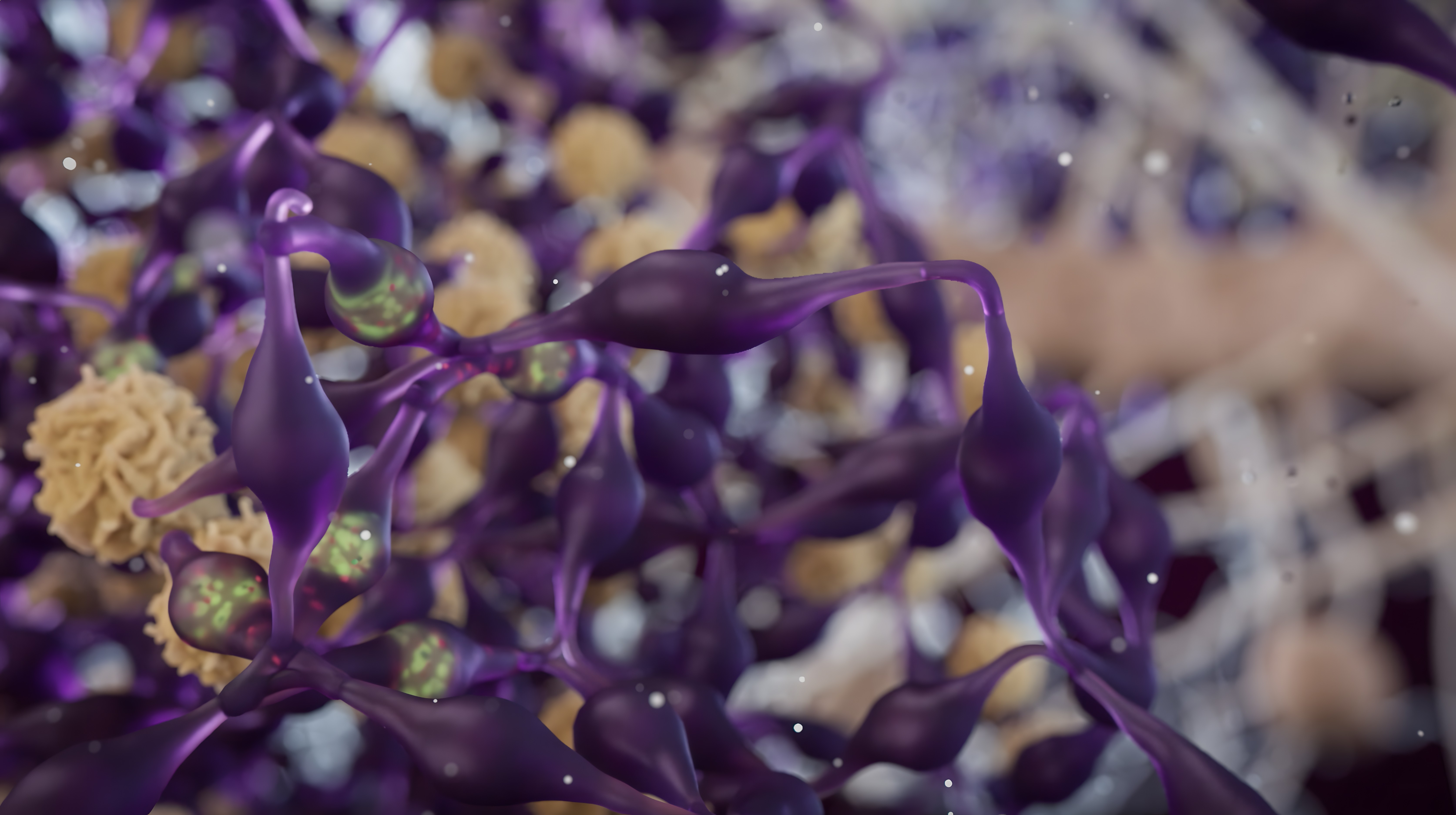 Glioblastoma cells with gene therapy constructs visible inside