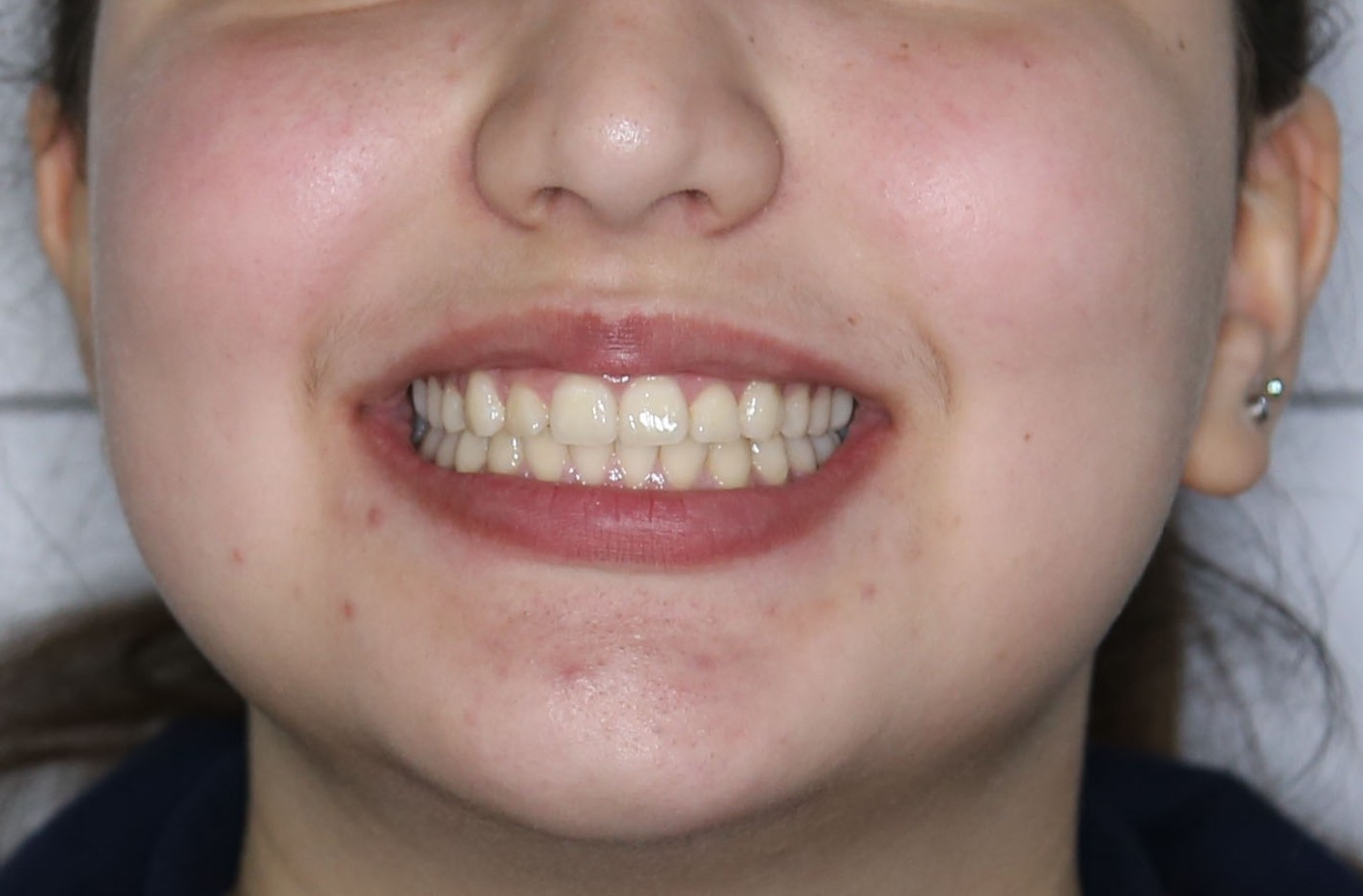 Image of teeth checkup