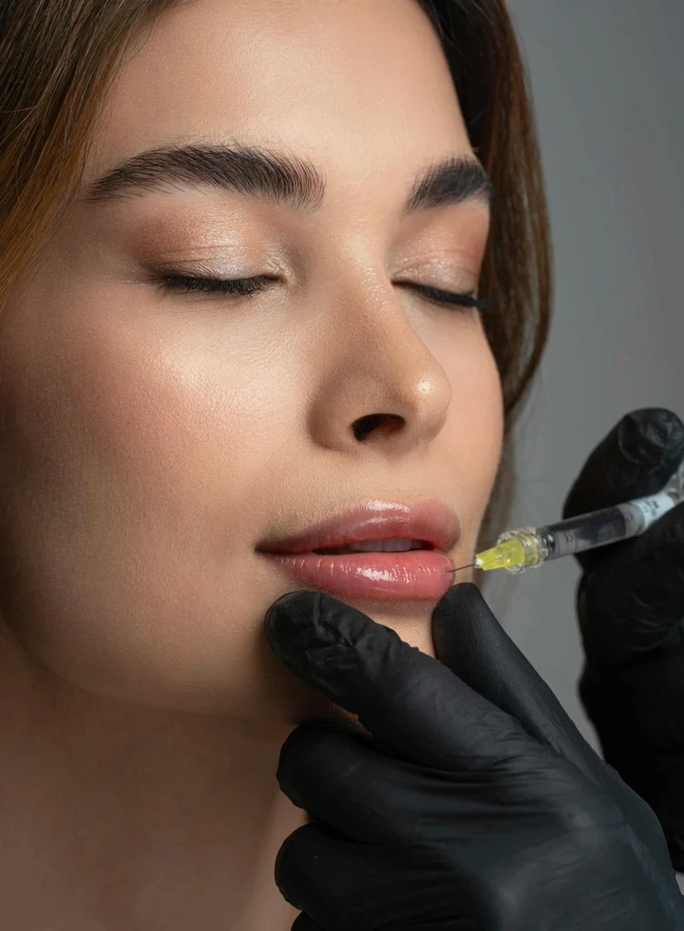 Woman getting dermal lip fillers treatment