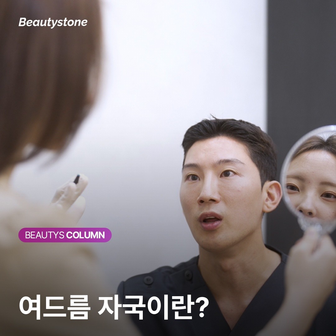 [위영진 칼럼] 여드름 빨간자국, 레이저보다 장벽 관리가 먼저인 이유