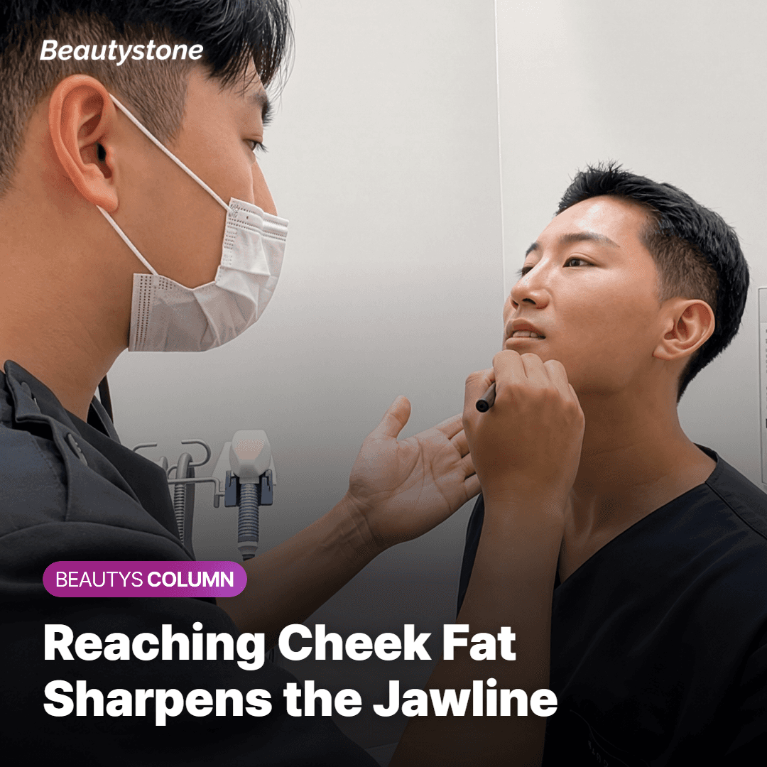 How heat reaching the cheek fat layer refines the jawline