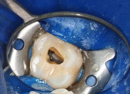 Het beeld door de microscoop