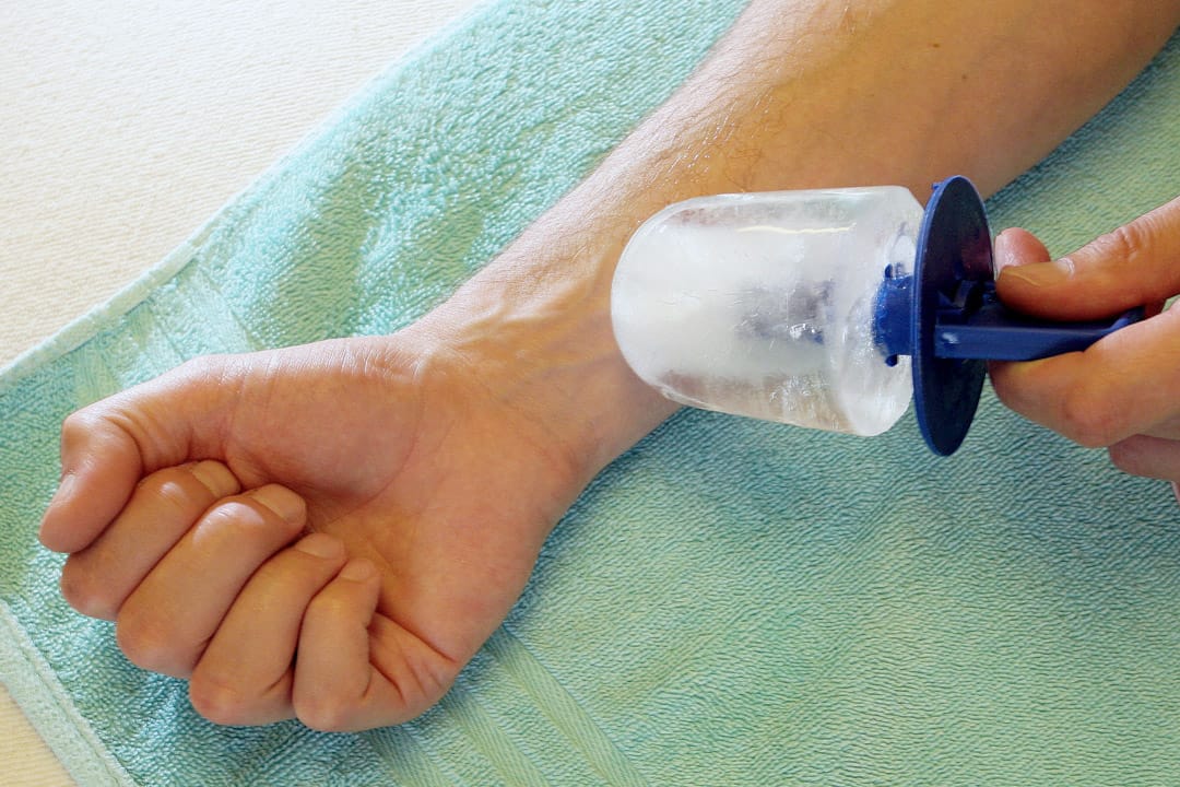 Manuelle Therapie – mobilisierende Handgriffe