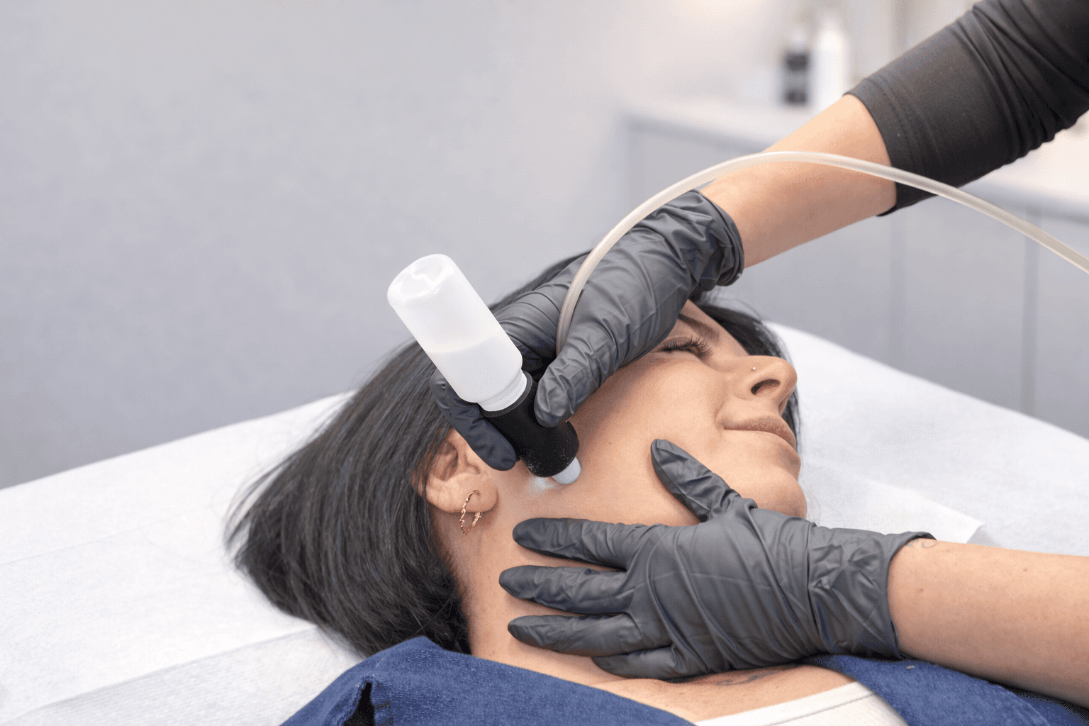 Client receiving a Microdermbrasion facial treatment using a professional device in a clinical setting