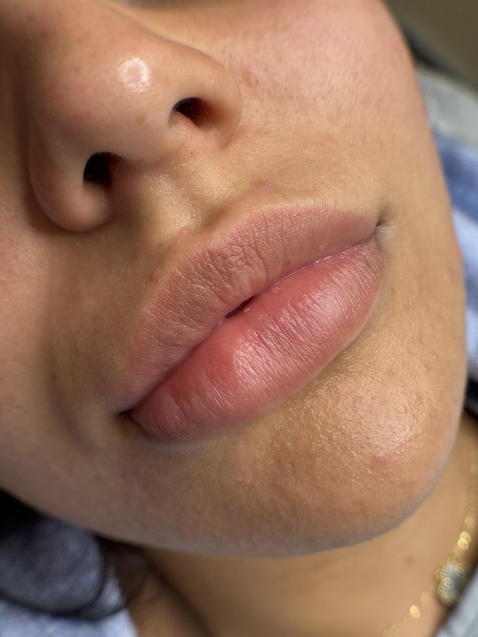 Before Lip blush permanent makeup results Boston