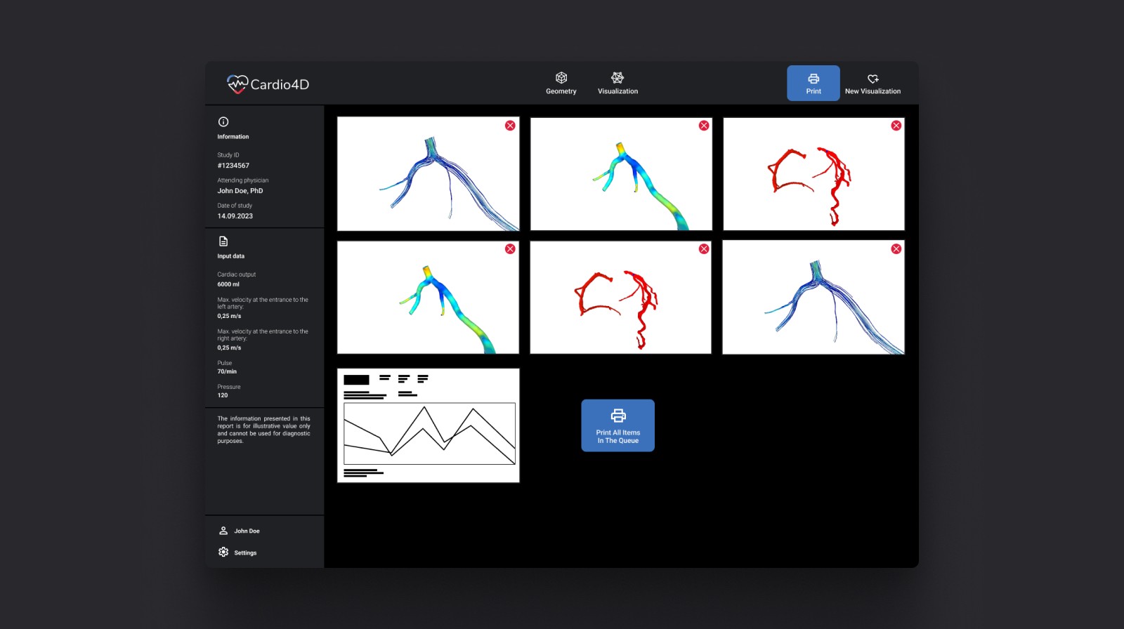 Laptop showing Bloomy UI