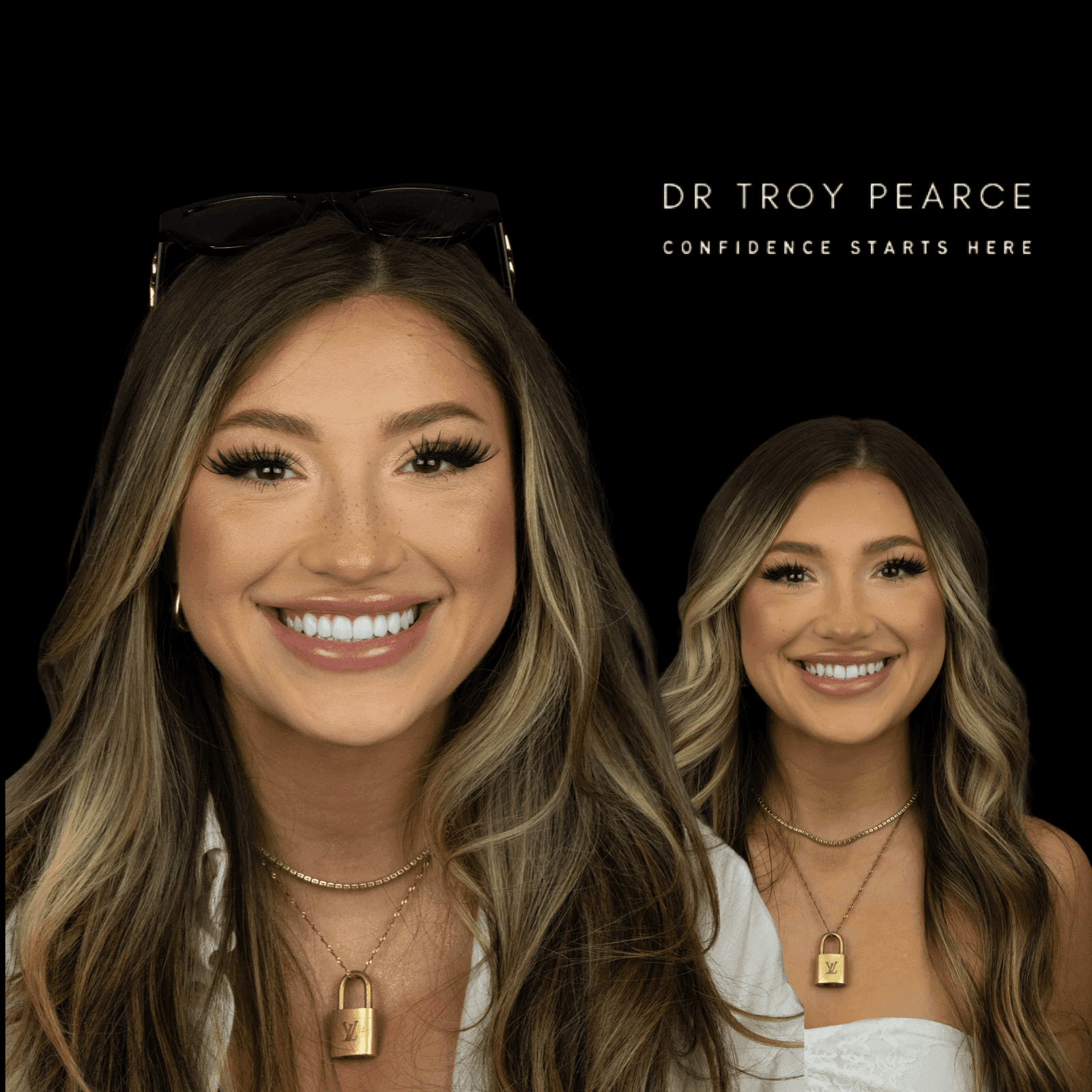 cosmetic dentistry candidate