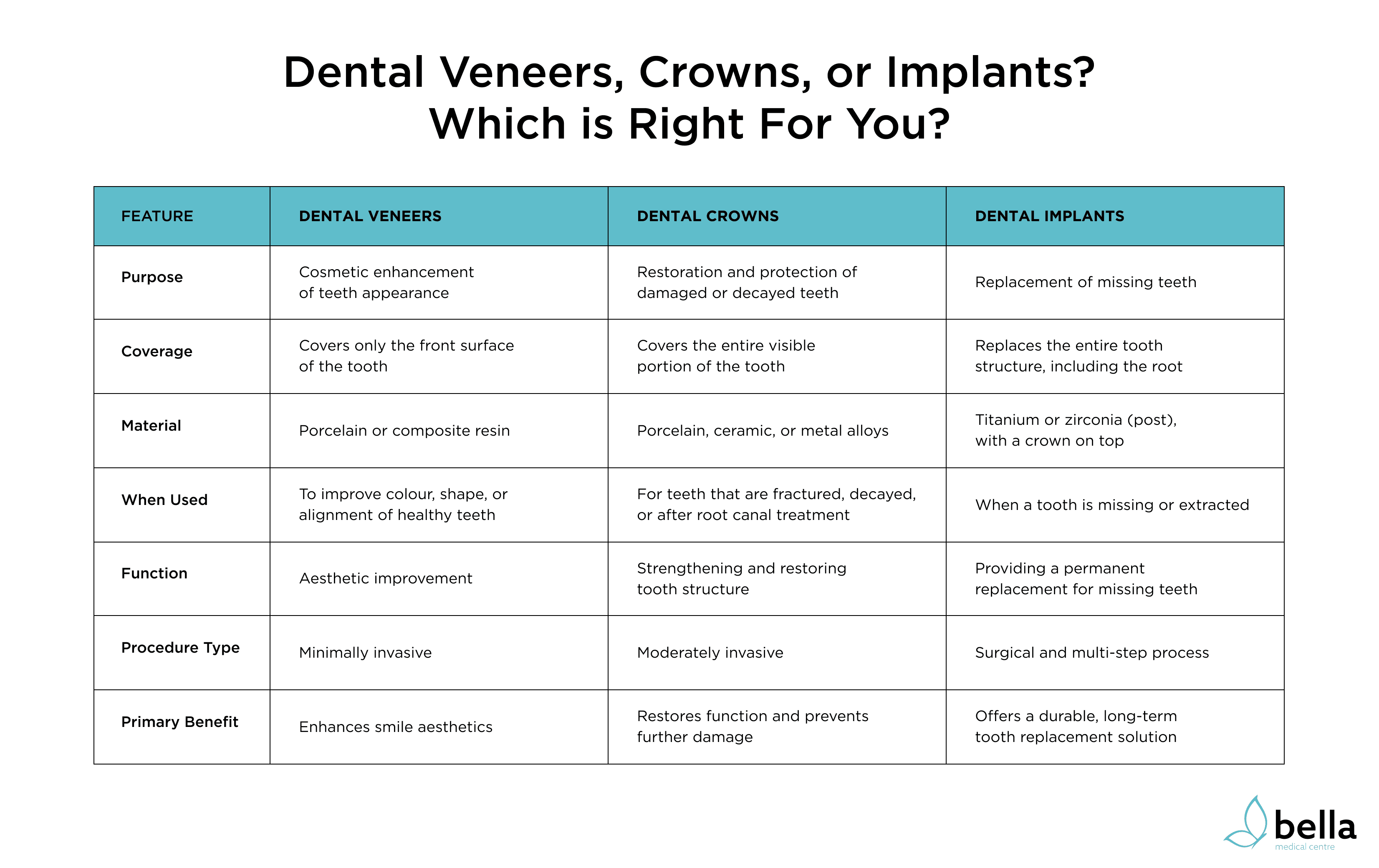 Comparing dental veneers with crowns and implants.