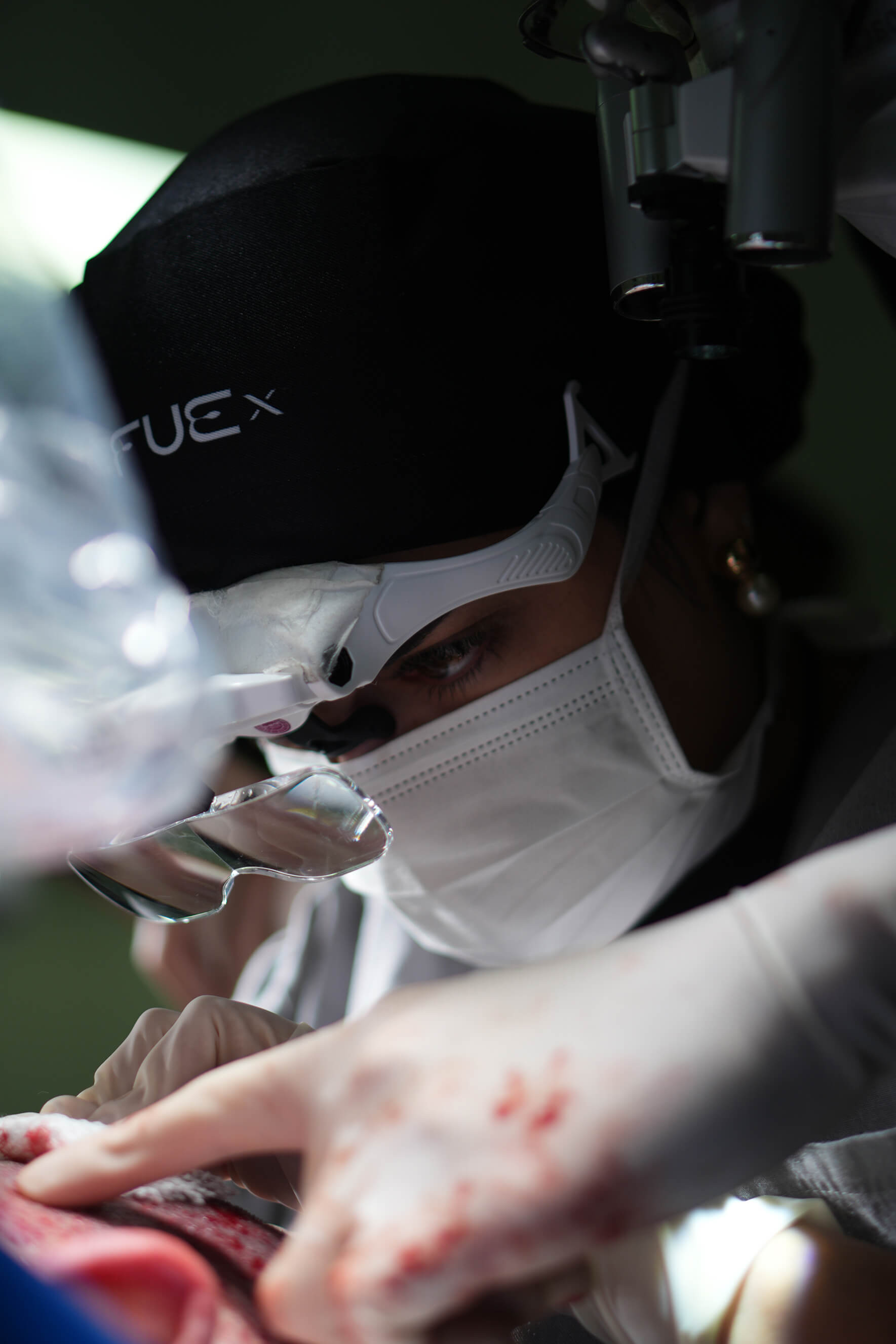 Médica fazendo um transplante capilar. 