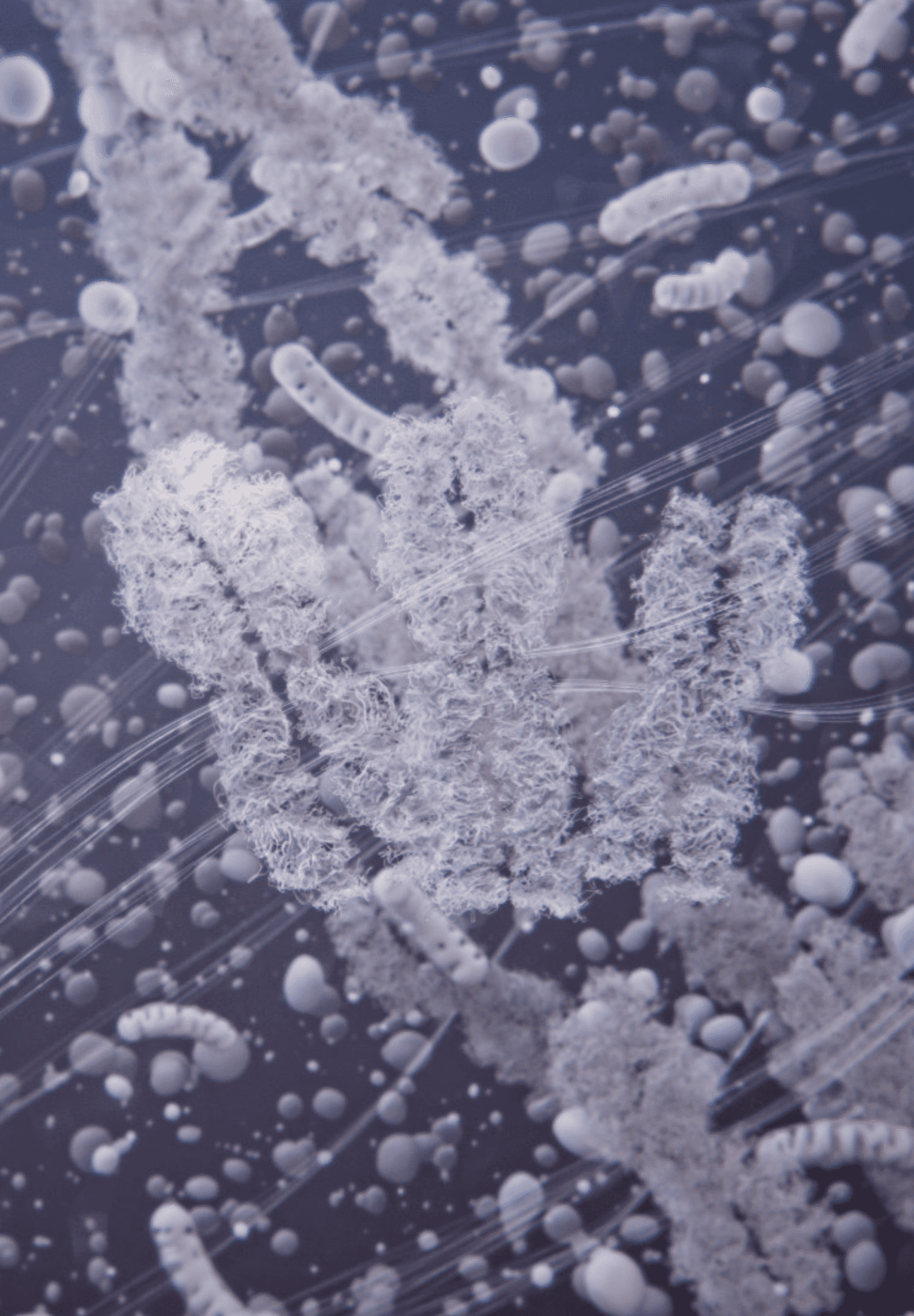 Condensed chromosomes