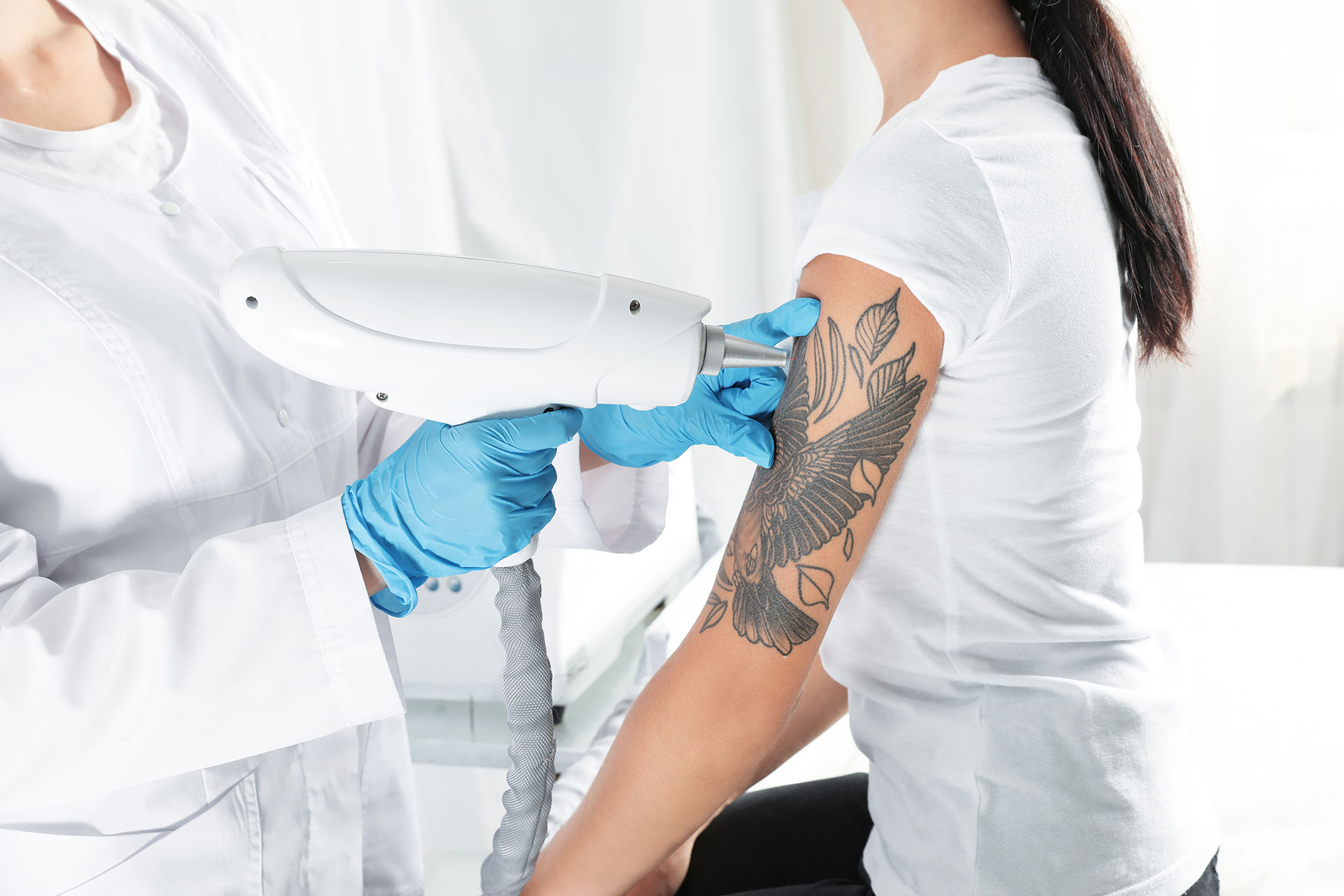 Eliminación de tatuajes (Láser) en Terrassa, Heaven Clinics