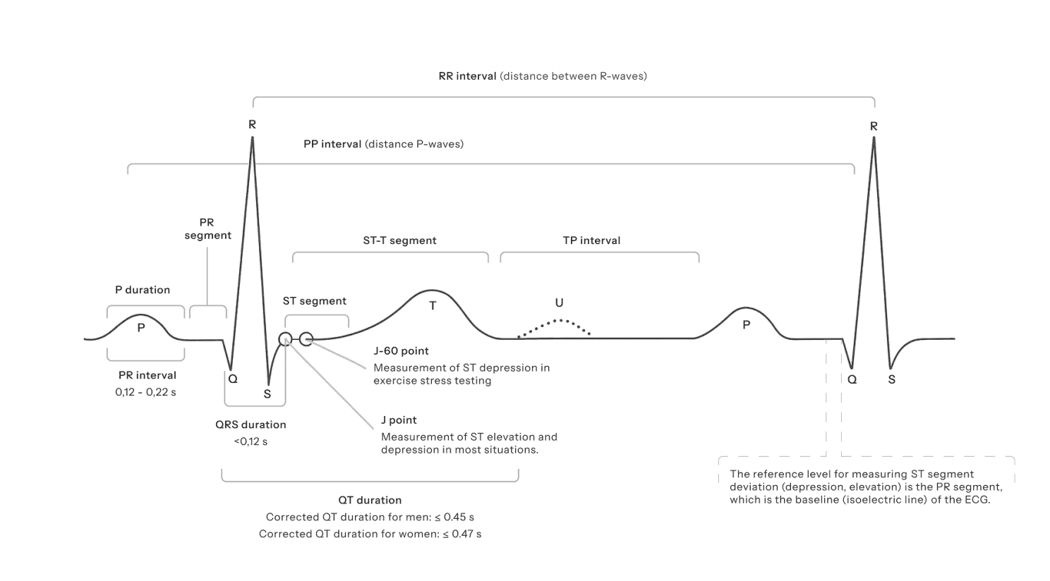 A sample ECG waveform. X-axis: "Time in ms" | Y-axis: "Voltage in mV"