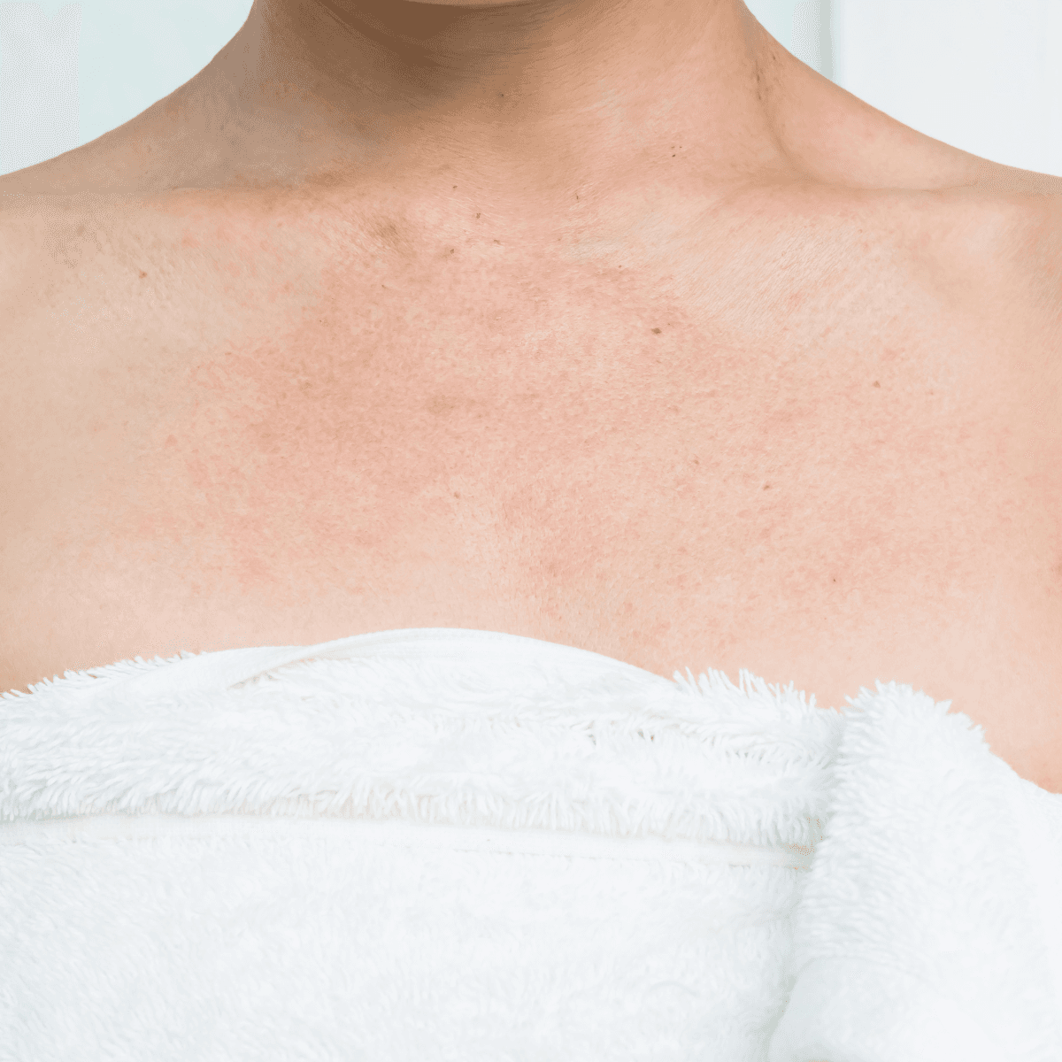 Eczema pendant la grossesse