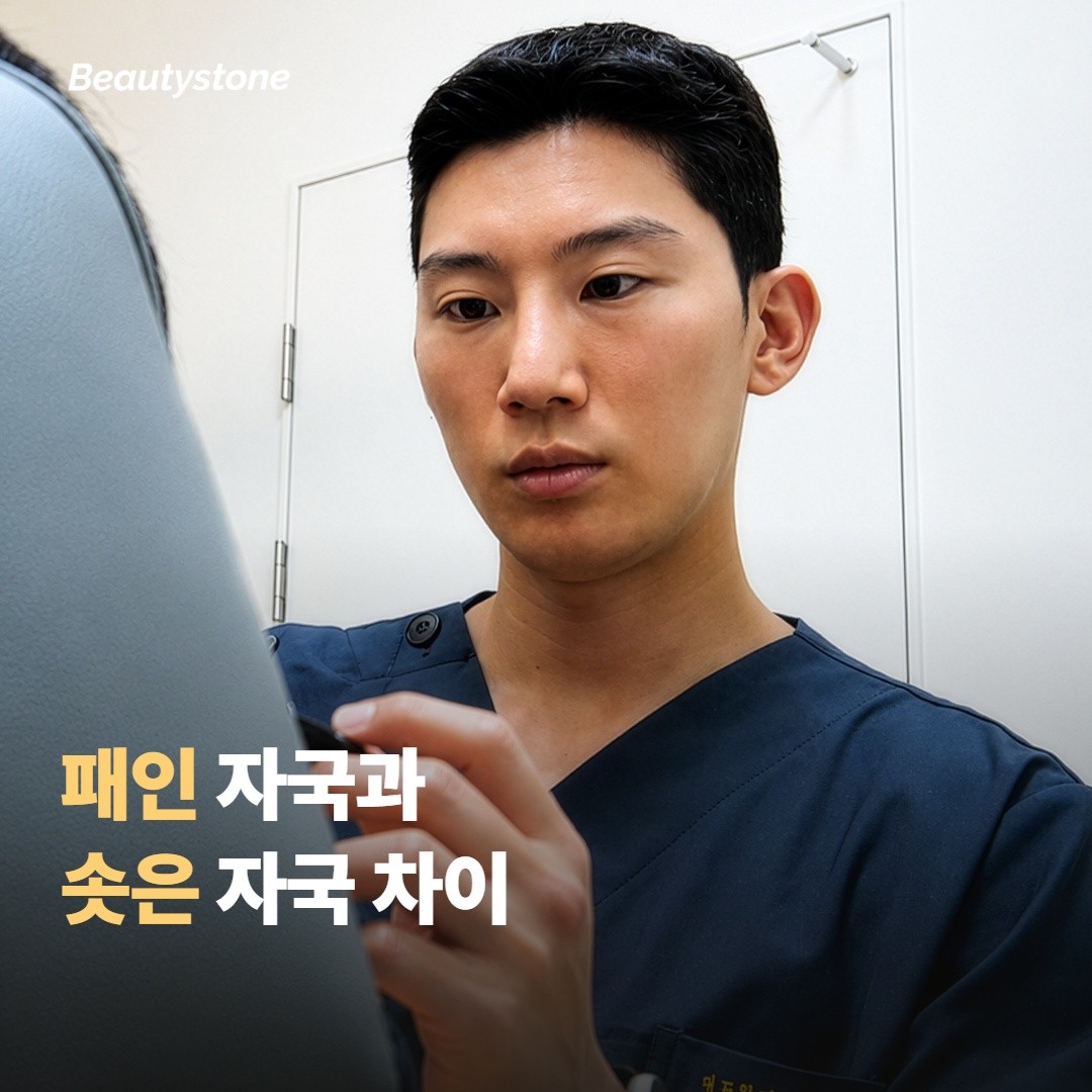 패인 흉터와 솟은 흉터는 또 달라요