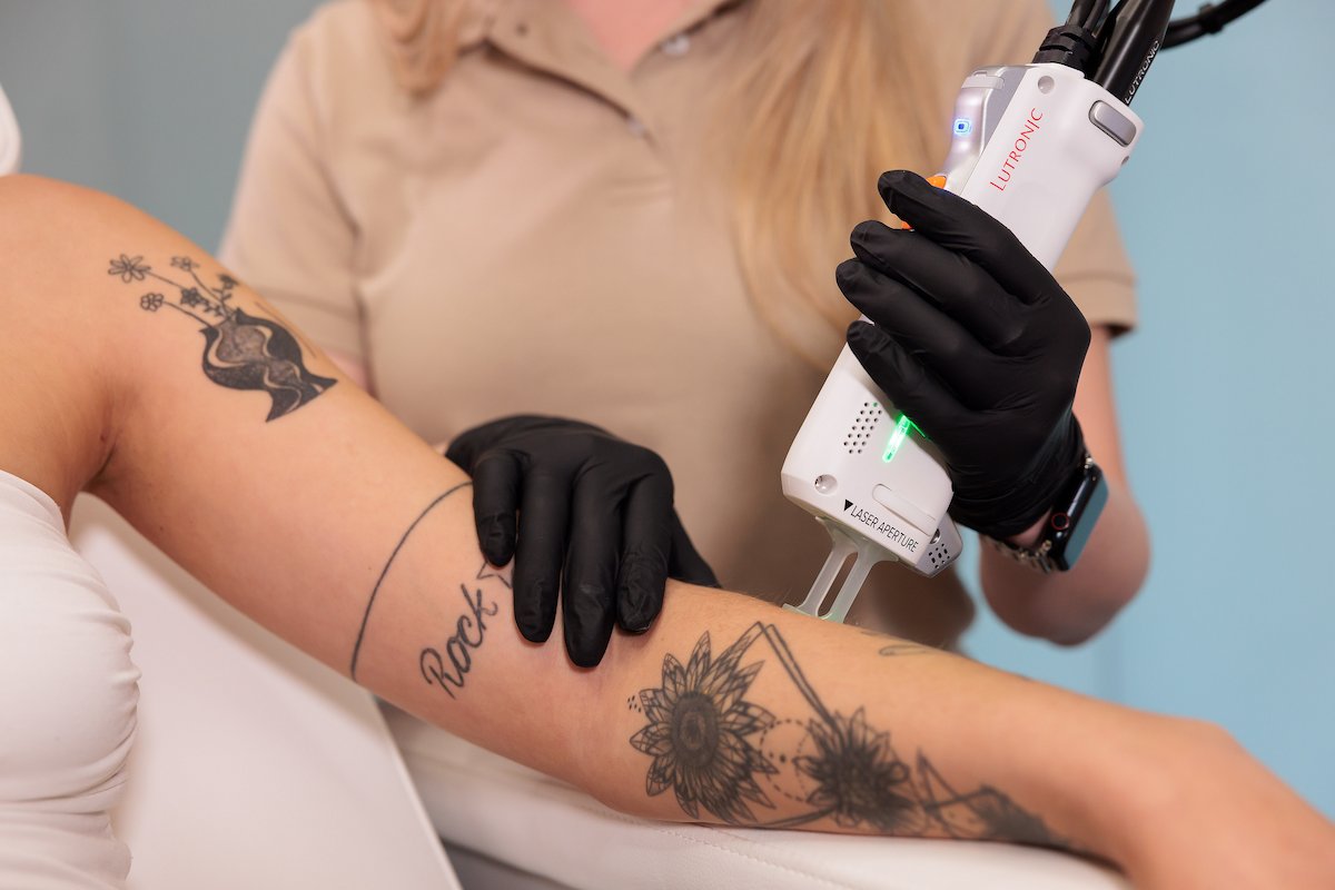 Frau bei Laser-Haarentfernung am Unterarm