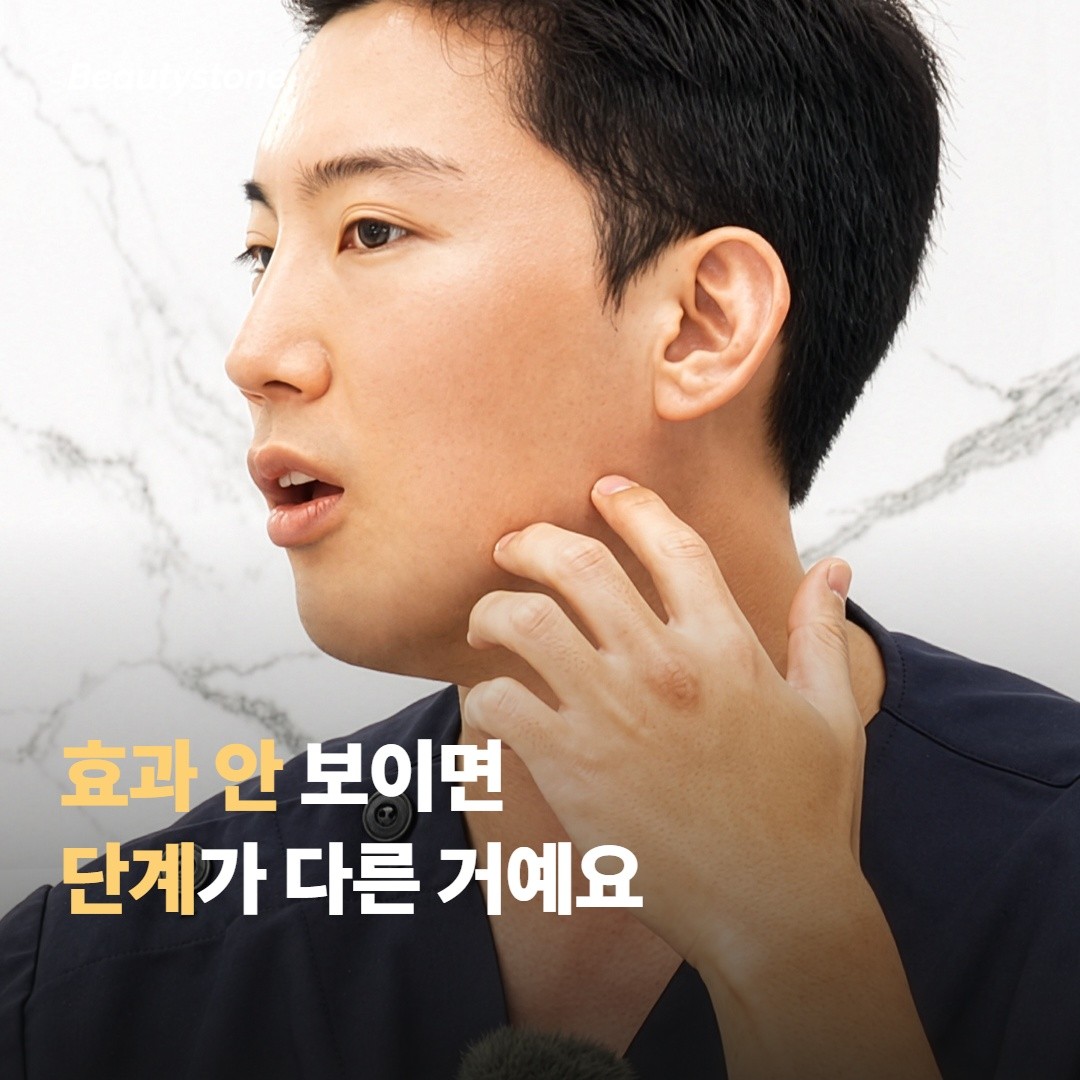 효과 안 보이는 분 — 너무 처졌거나, 너무 젊거나
