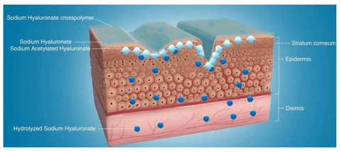 Sodium Hyaluronate Gel for Wrinkle Reduction: How Does It Work?