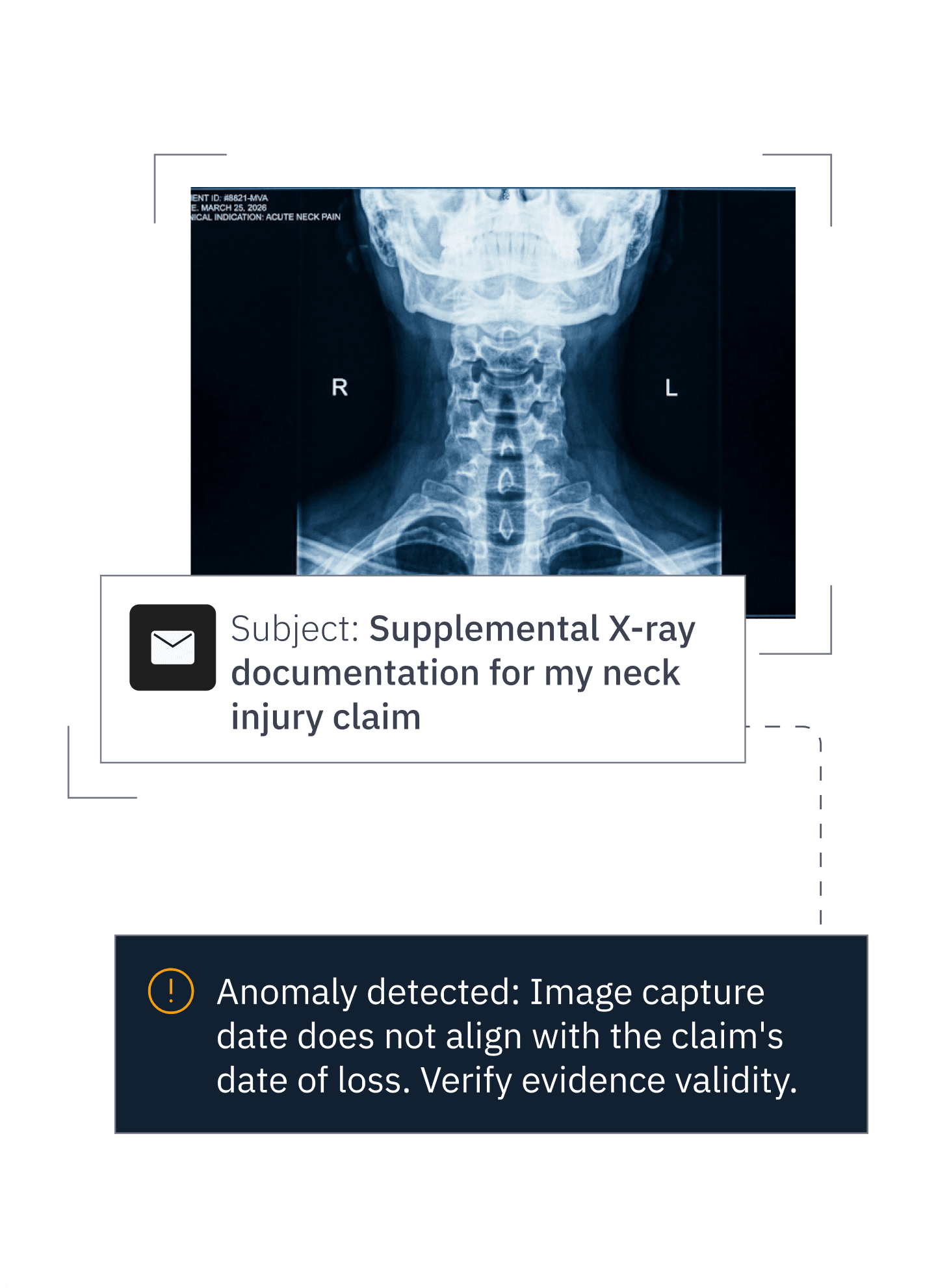 Neck X-ray supplemental documentation anomaly detected.