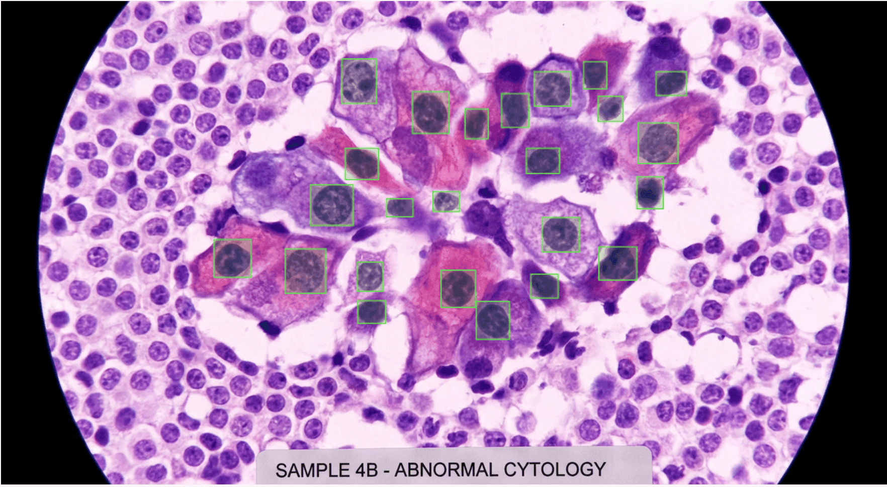 AI for microscope images