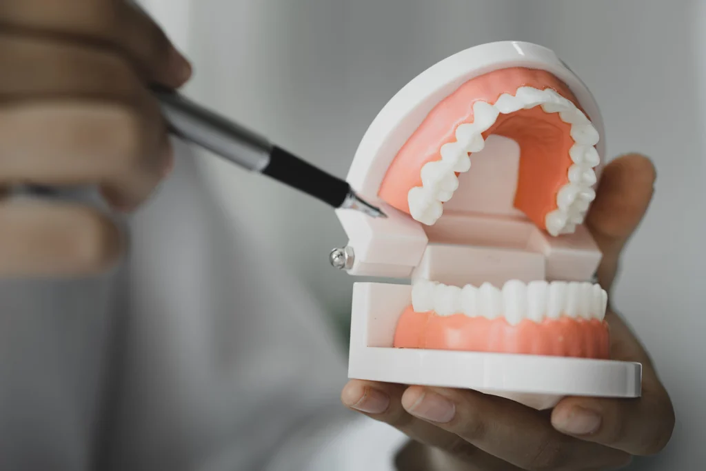 dental implant maintenance
