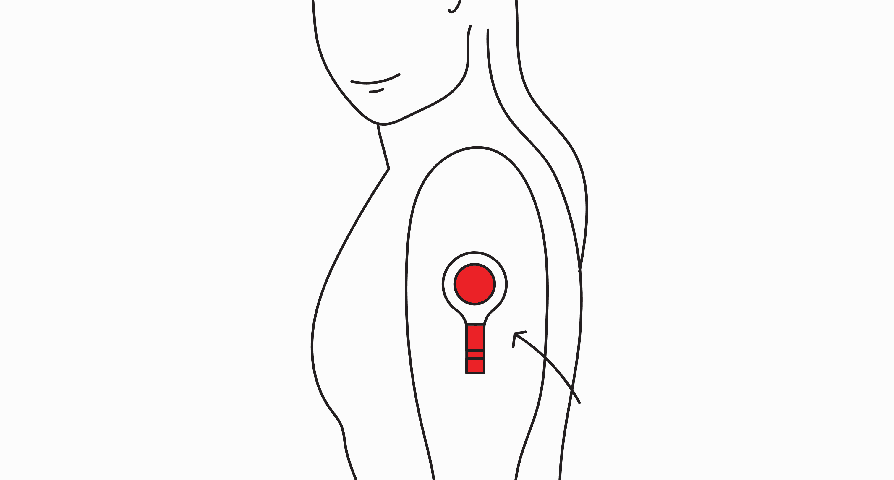 A line drawing of a person with a round red blood collection device on the side of their upper arm, with an arrow pointing upward to show the device should fill to the top.