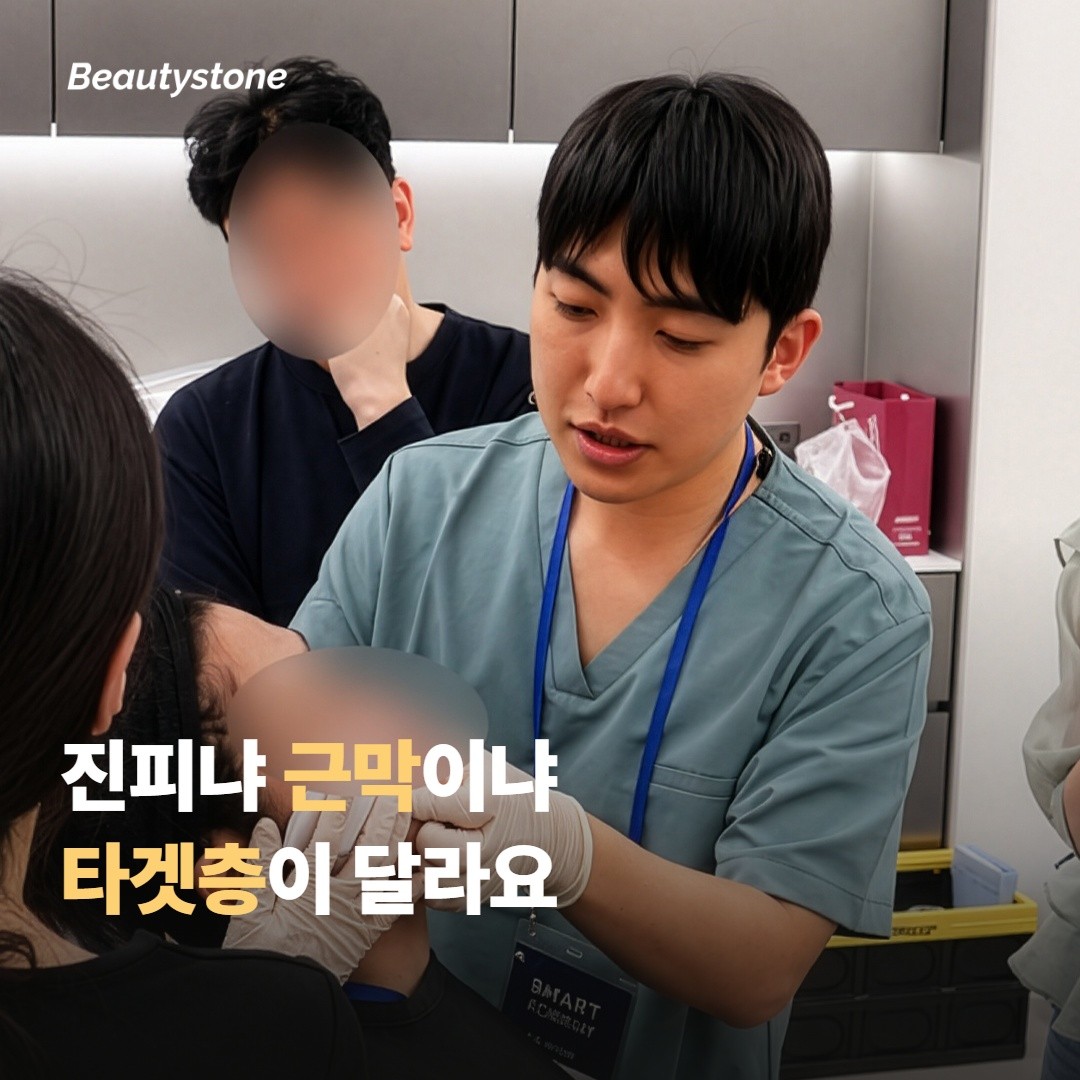 소프웨이브 vs 슈링크는 진피 중간층, 슈링크는 근막층까지 도달해요
