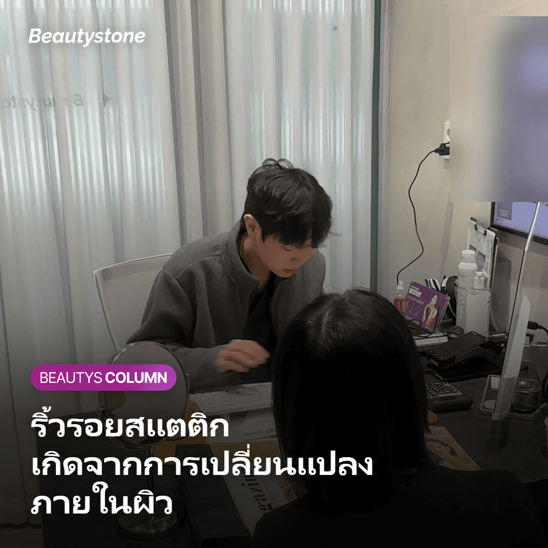 ภาพแสดงว่าริ้วรอยแบบสแตติกเกิดจากการเปลี่ยนแปลงภายในผิว