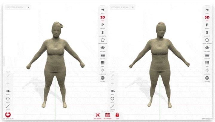 Styku before and after 3D body comparison