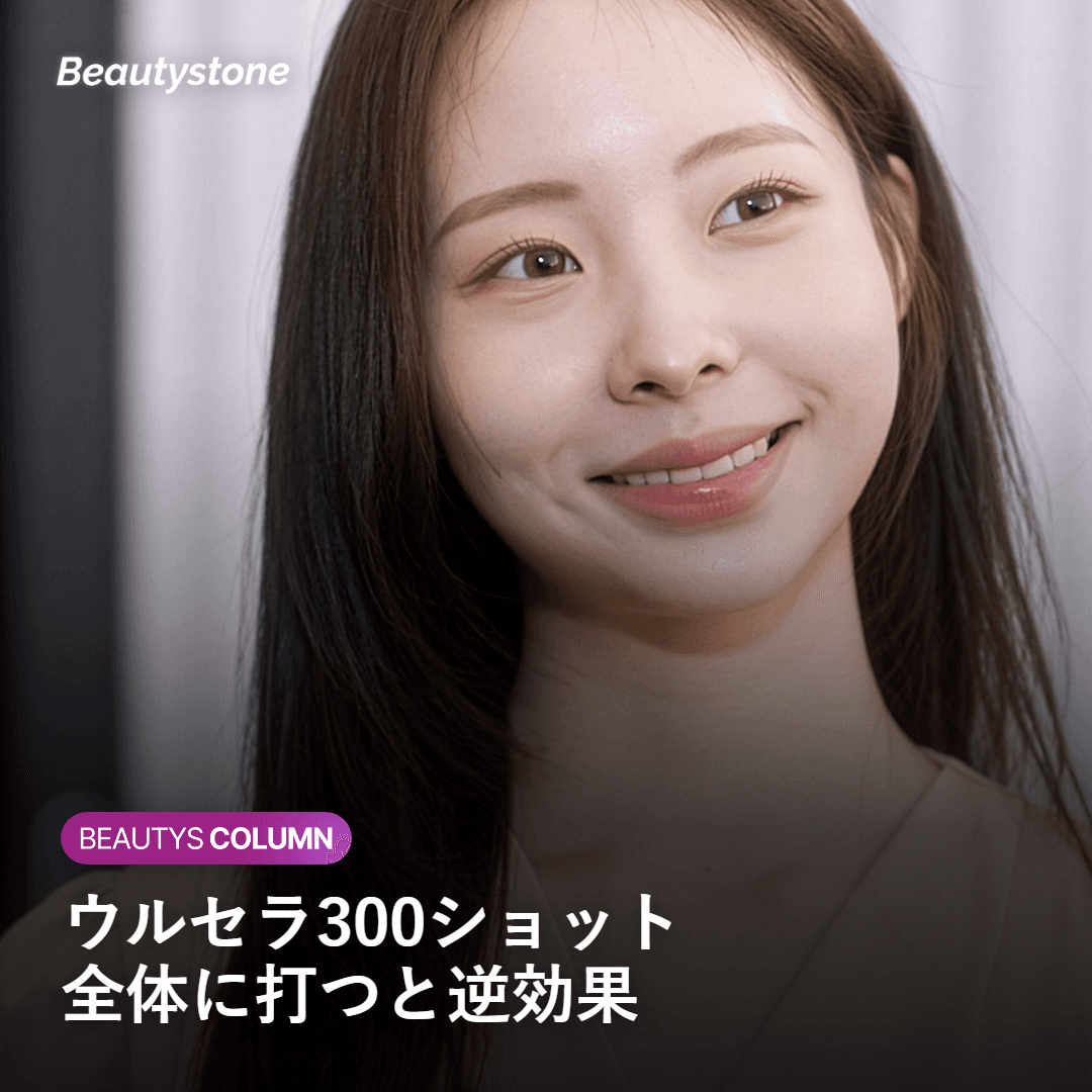 ウルセラ300ショット 頬骨・目元への集中施術