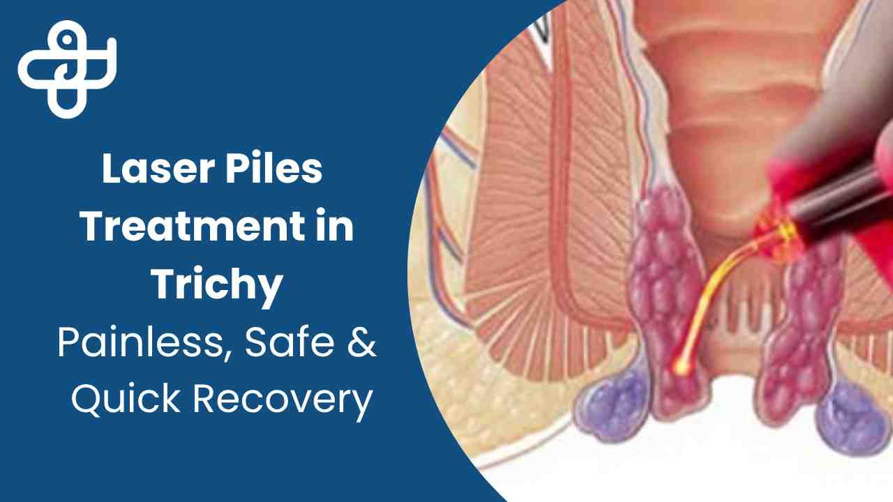 Laser piles treatment in trichy